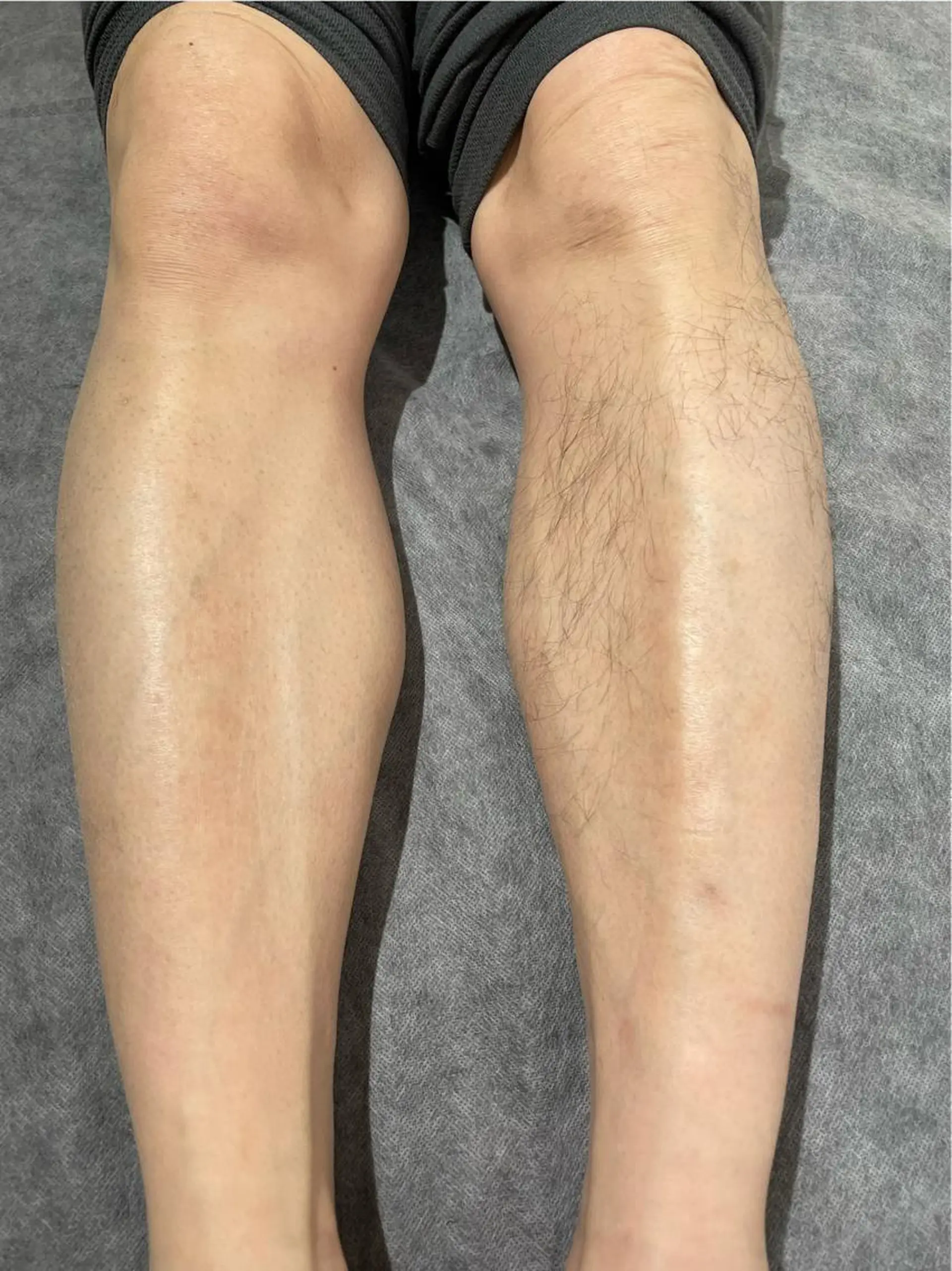 メンズ キッズ 脱毛 さろんどふじた甲子園所属・江嵜 真由美　　　　甲子園のマツエク・マツパデザイン