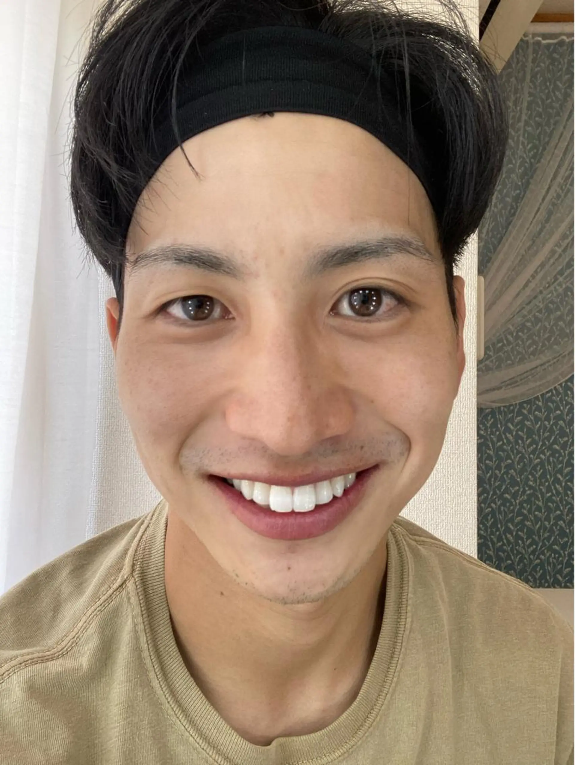 メンズ プラチナムビューティー柏所属・【歯科提携】柏ホワイ トニングスタイルのその他イメージ