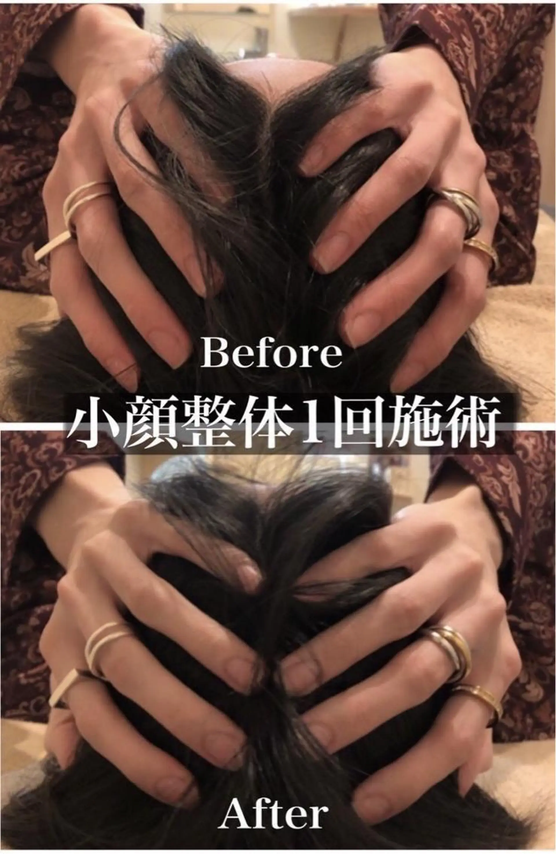 その他 鍼灸整骨院Refine所属・鍼灸 Refineのその他イメージ