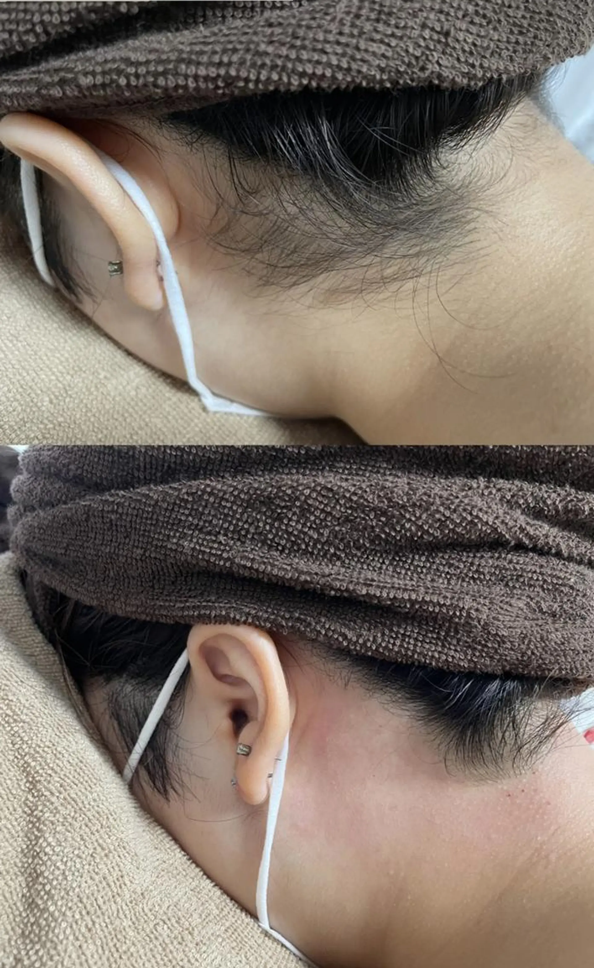 ショート メンズ 脱毛 Epina 千葉店 【エピナ】のエステ・リラクイメージ