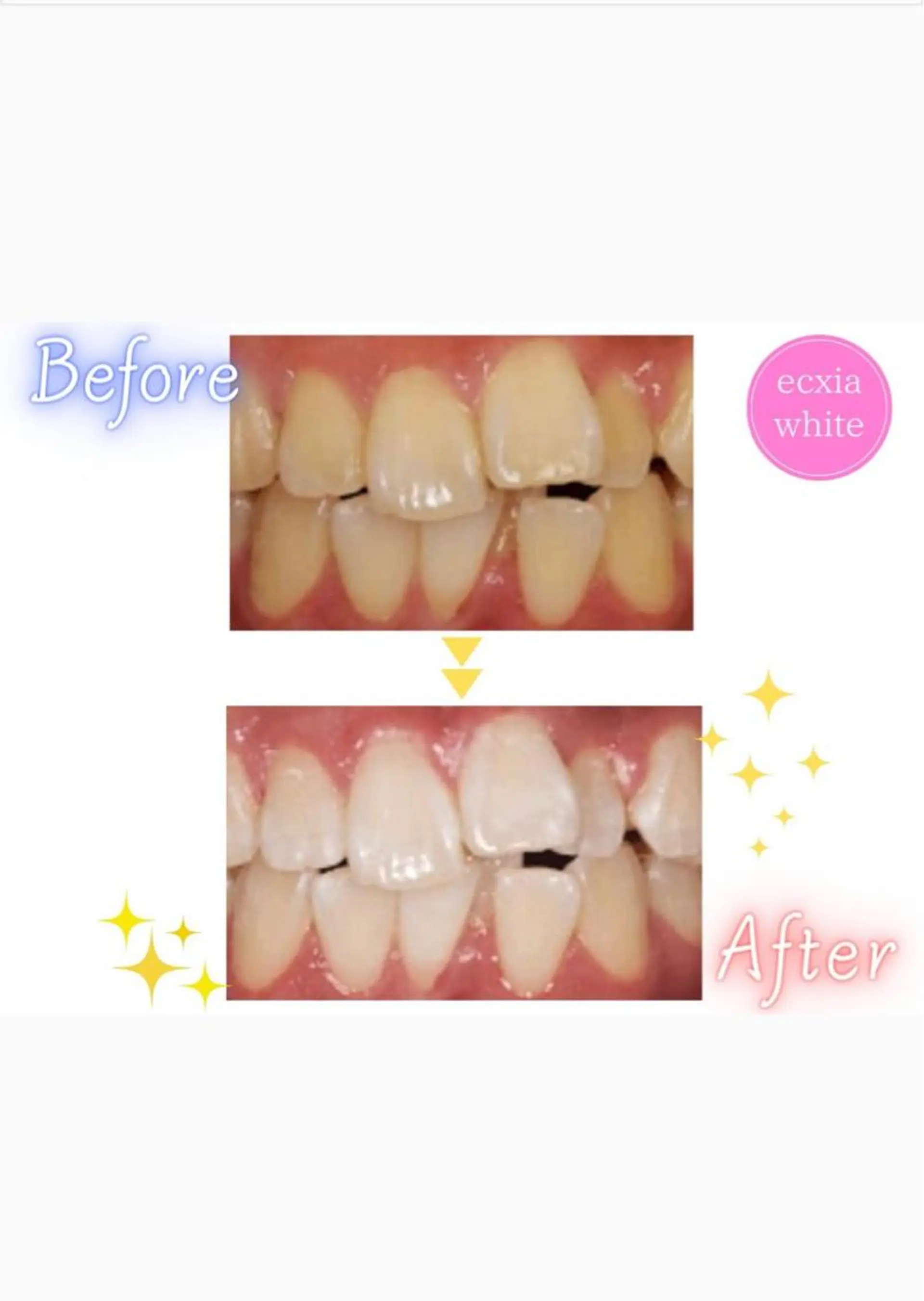 ecxia  white 　広島袋町店所属・セルフホワイトニング エクシア広島袋町店のその他イメージ