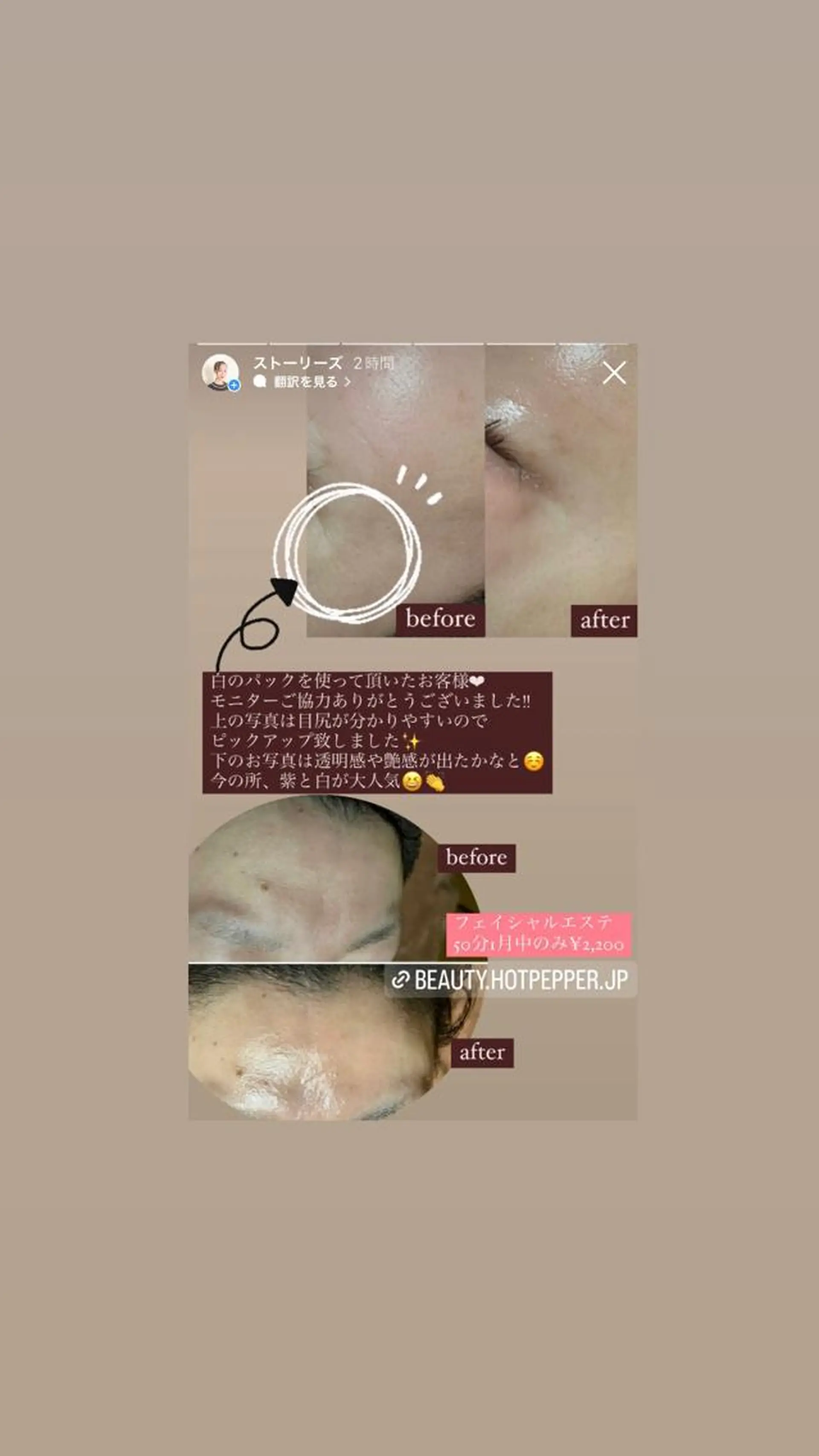 アイカワールド所属・鈴木 愛加のエステ・リラクイメージ