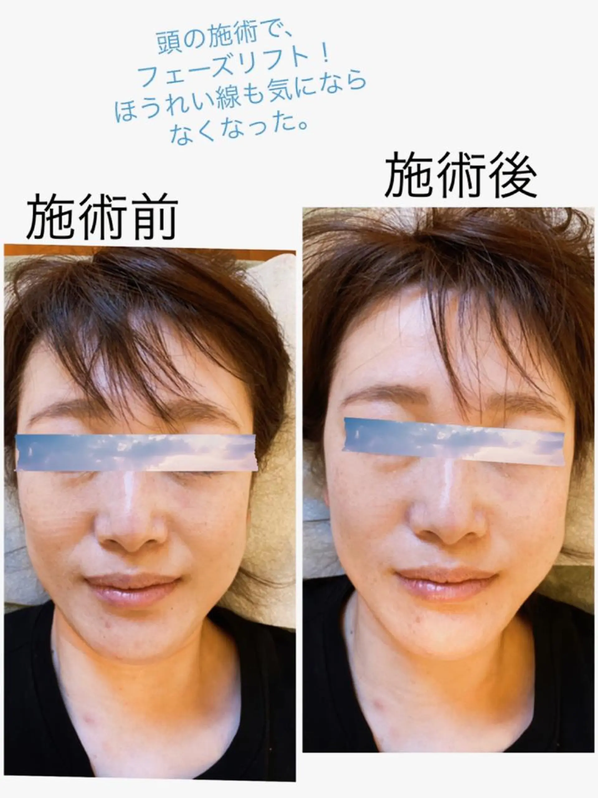 Anne’s happyBonesのエステ・リラクイメージ