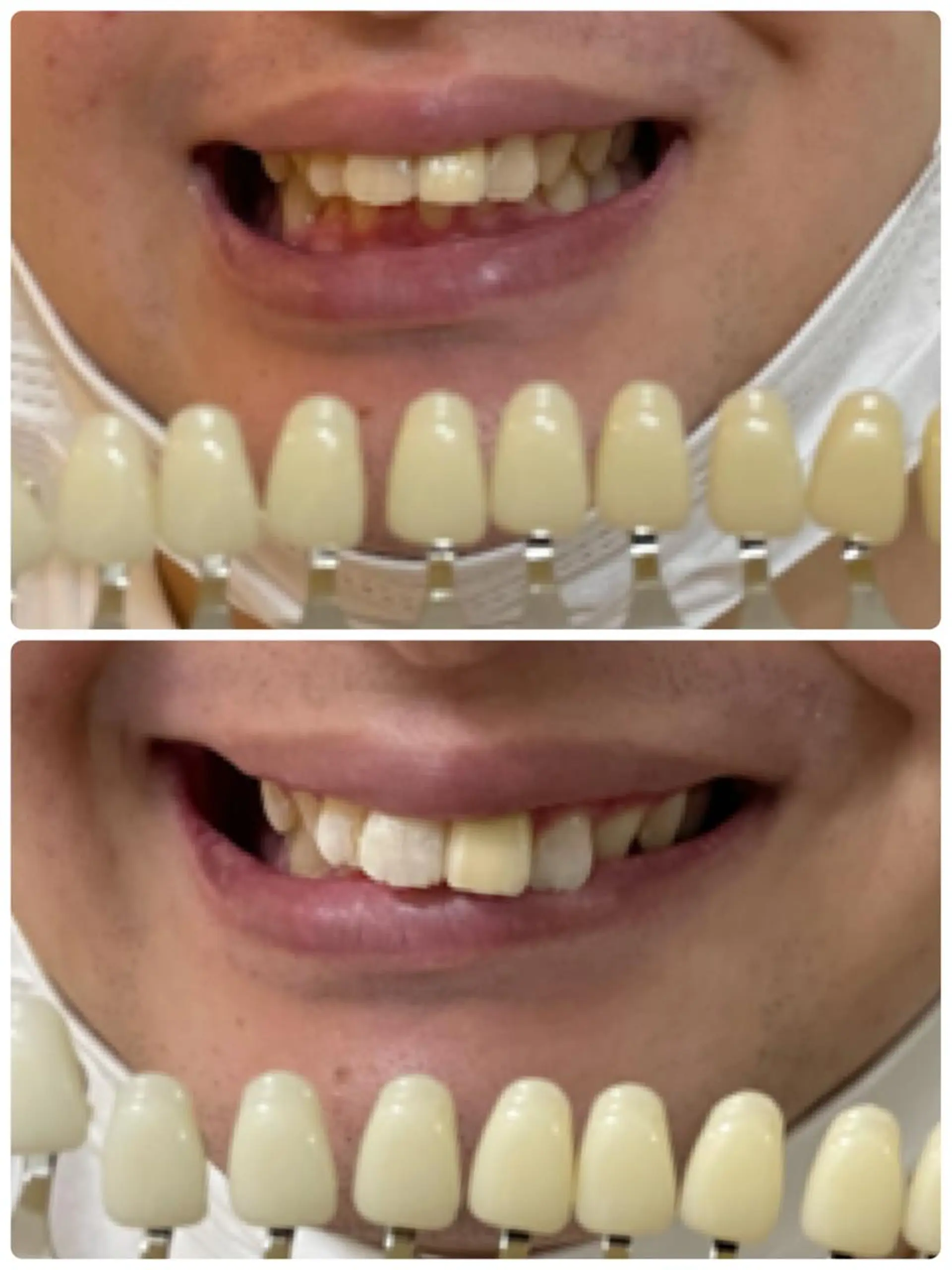 その他 bright梅田所属・甲斐 優衣のその他イメージ