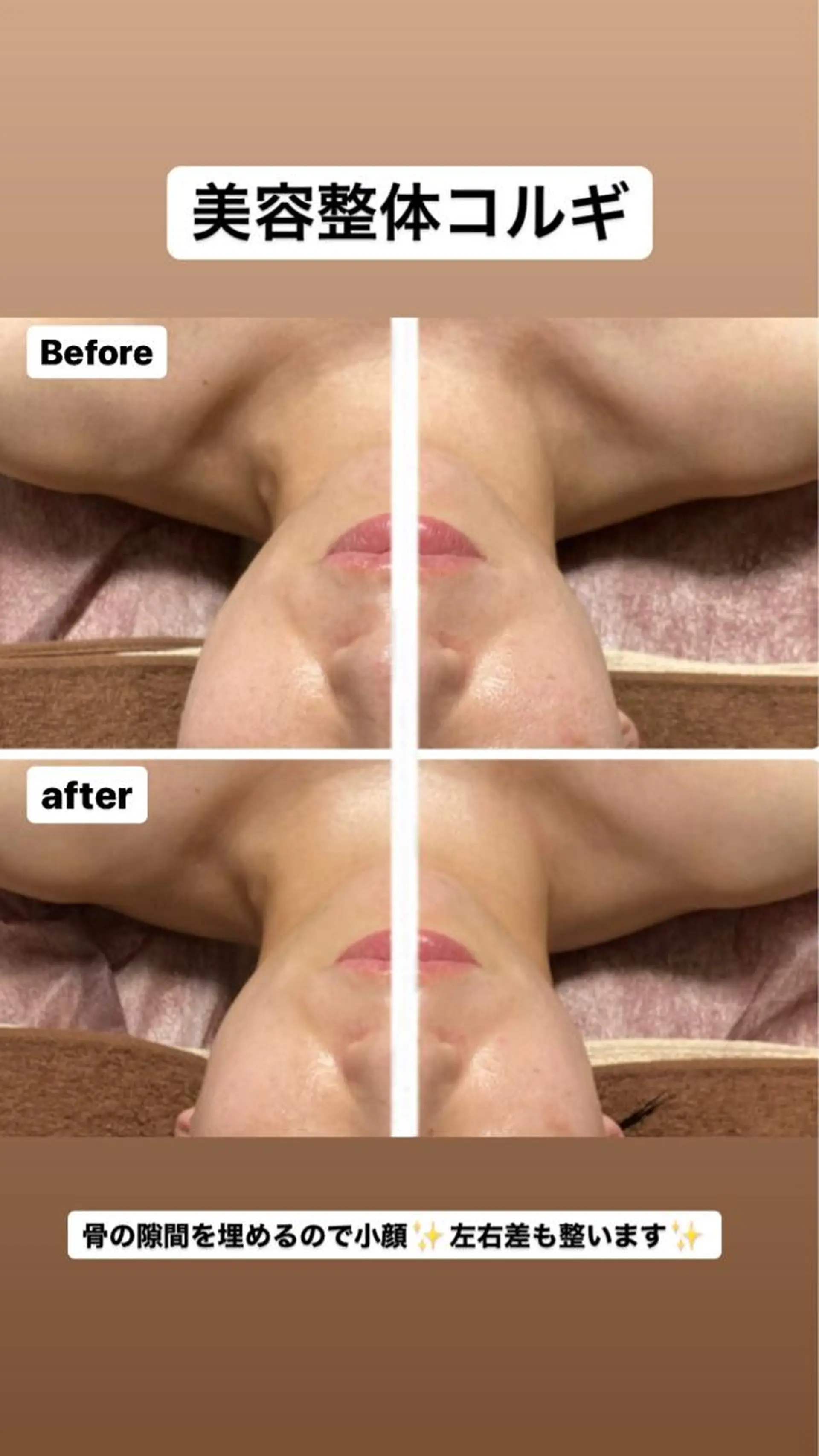 その他 美顔秘密基地新宮所属・美顔秘密基地 新宮のその他イメージ