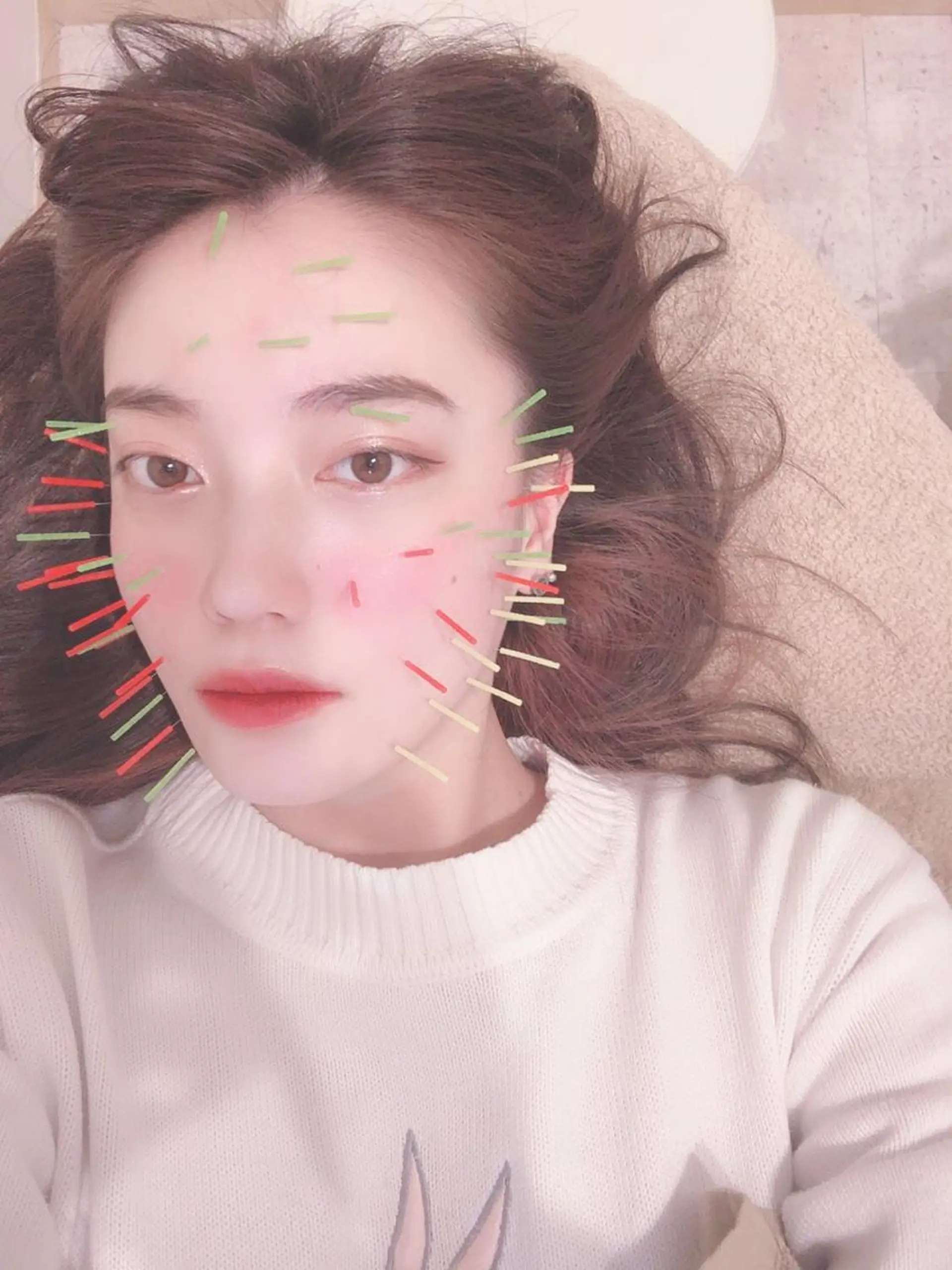 鍼灸整骨院Refine所属・鍼灸 Refineのその他イメージ