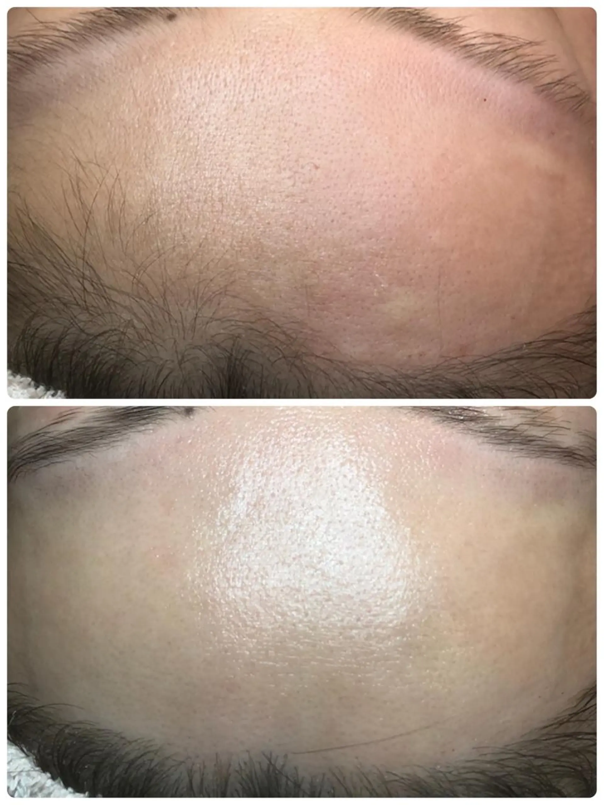 脱毛 兒玉 知代の眉毛・アイブロウイメージ