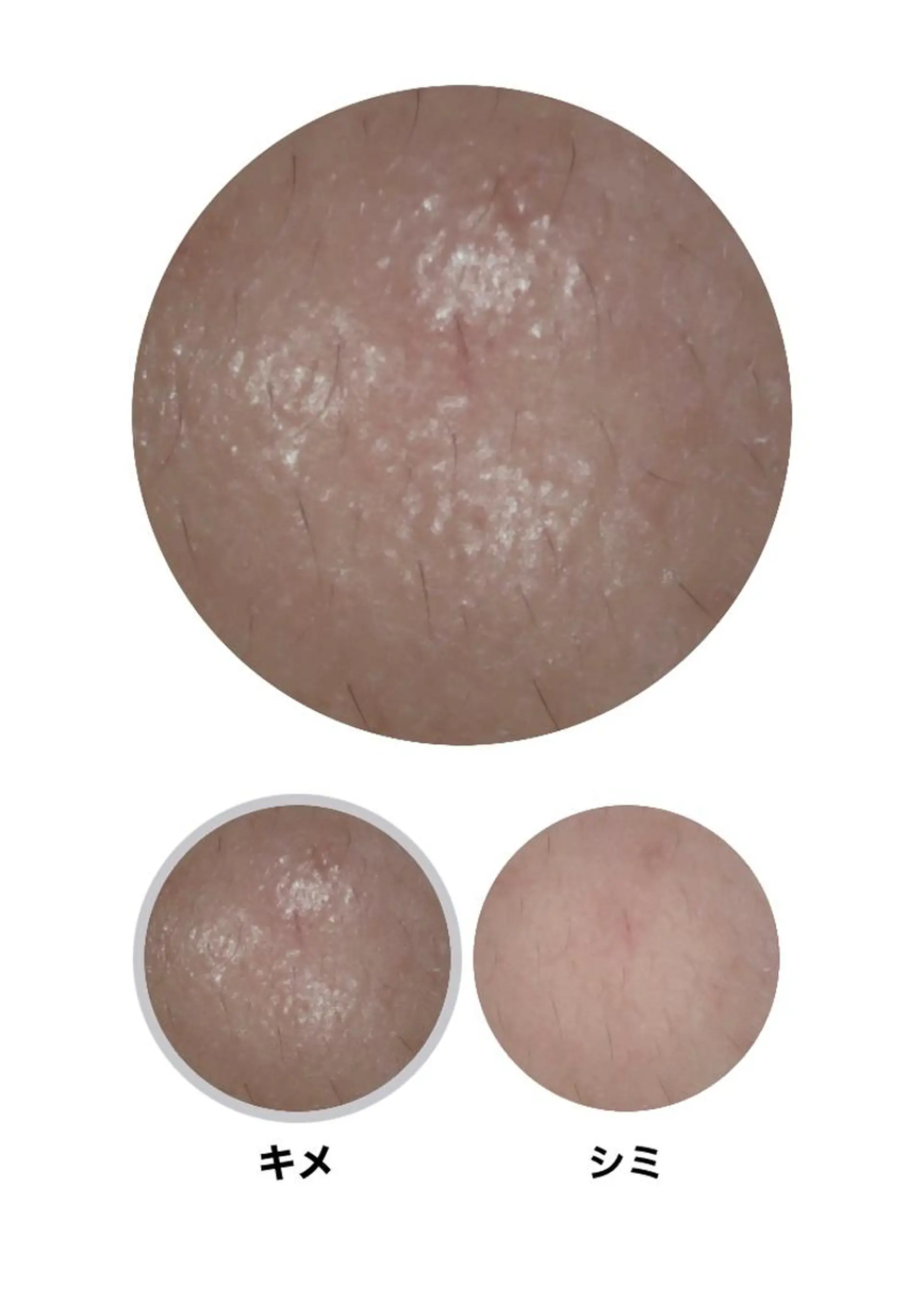 エステ メナードフェイシャルサロン天王寺駅東口代行店所属・メナード天王寺駅東口 稲冨恵美のエステ・リラクイメージ