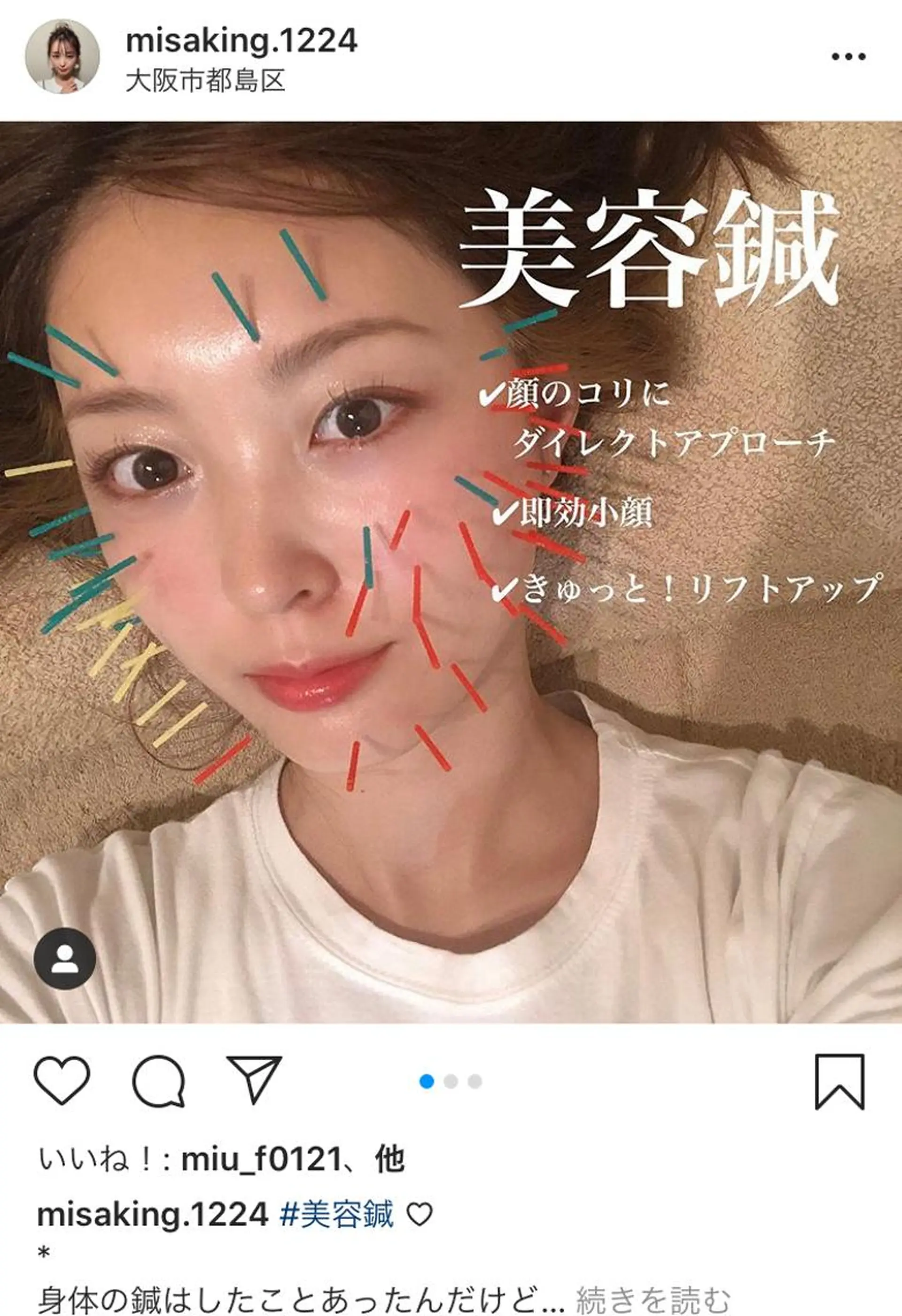 鍼灸整骨院Refine所属・鍼灸 Refineのその他イメージ