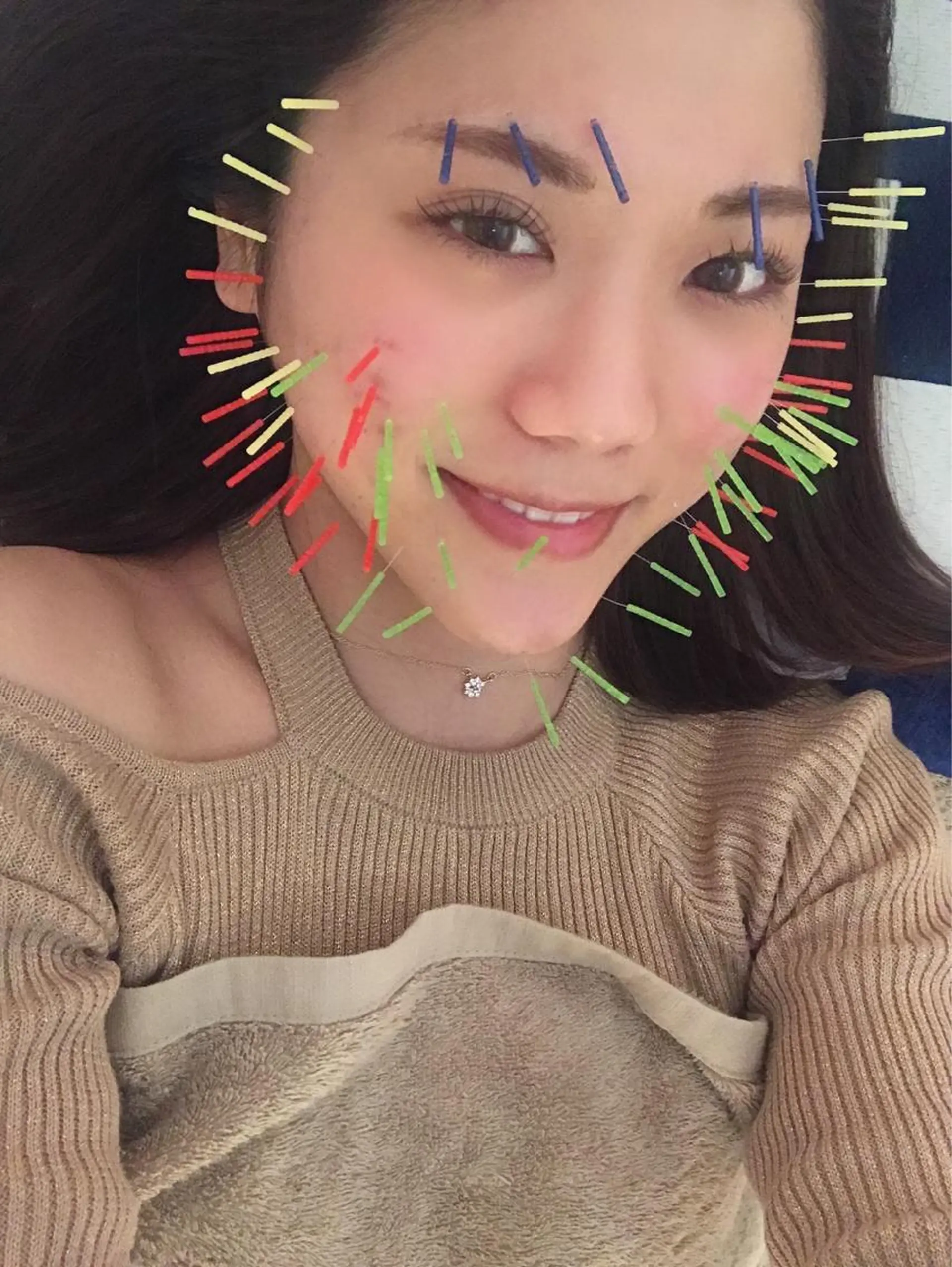 鍼灸整骨院Refine所属・鍼灸 Refineのその他イメージ