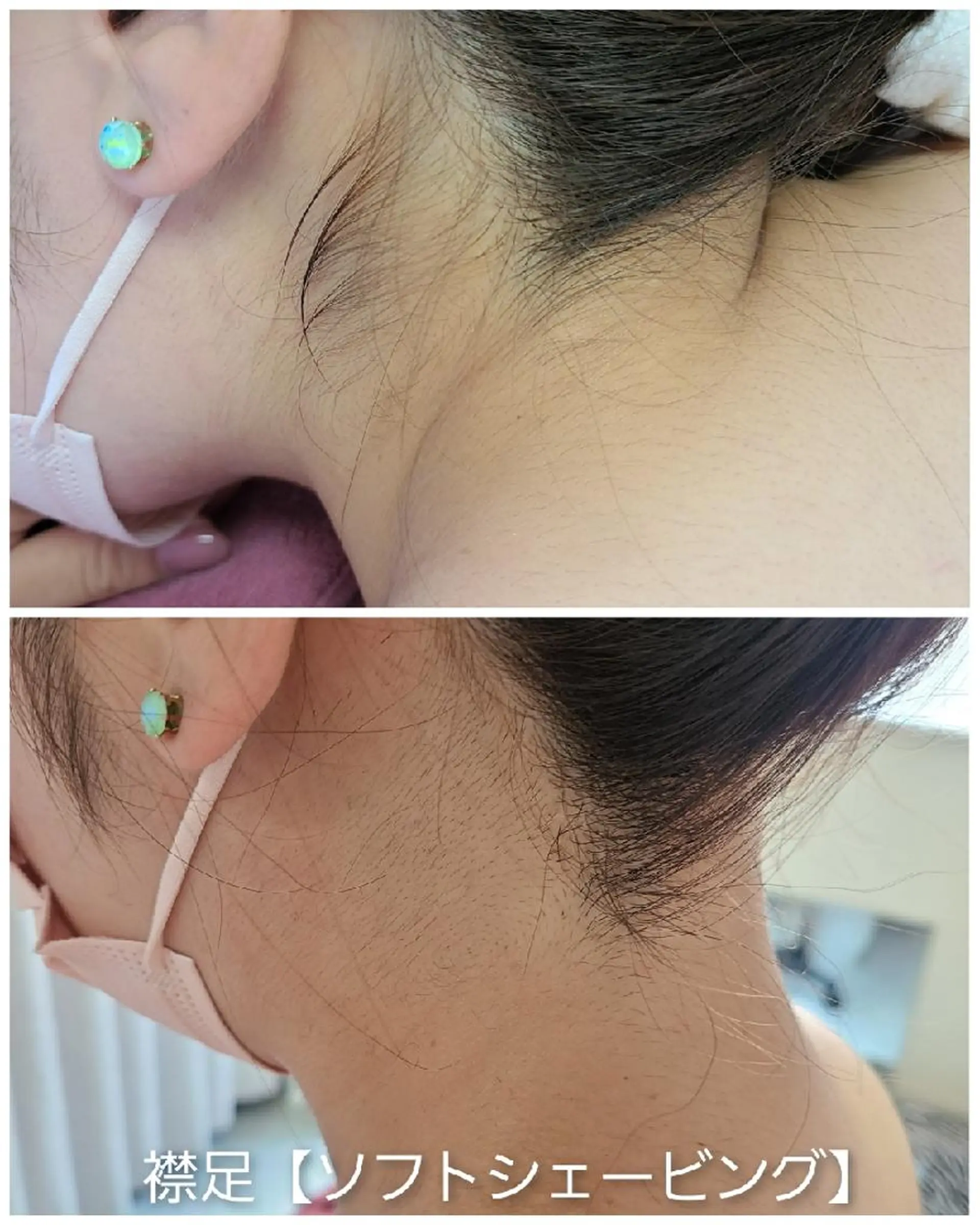 脱毛 パーソナルカラー・骨格/顔診断【eternity】所属・【トータル美容】 Eternityのその他イメージ