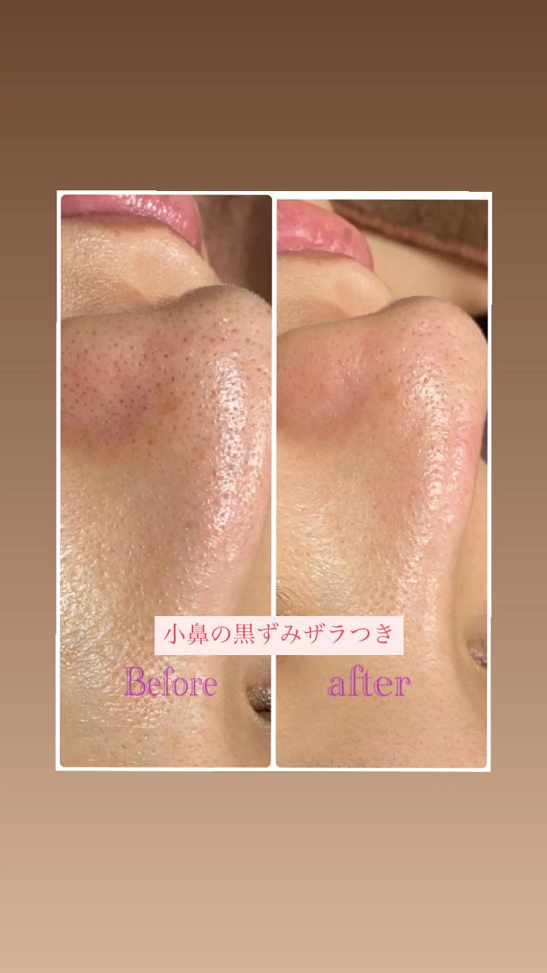 エステ リラク サロンドプララン所属・サロンド プラランのエステ・リラクイメージ