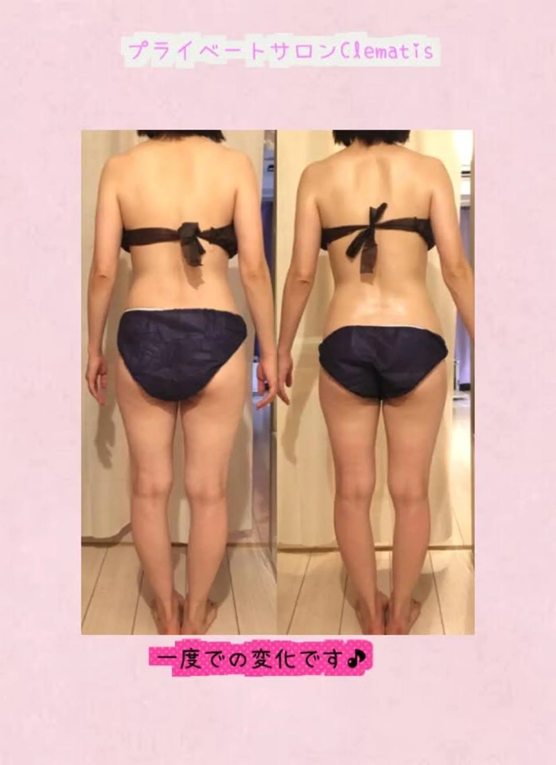 ショート カラー パーマ ヘアアレンジ メンズ キッズ マツエク・マツパ ネイル 強圧オールハンド痩身&黄土よもぎ蒸しプライベートサロンClematis池袋所属・強圧オールハンド痩身 片野のエステ・リラクイメージ