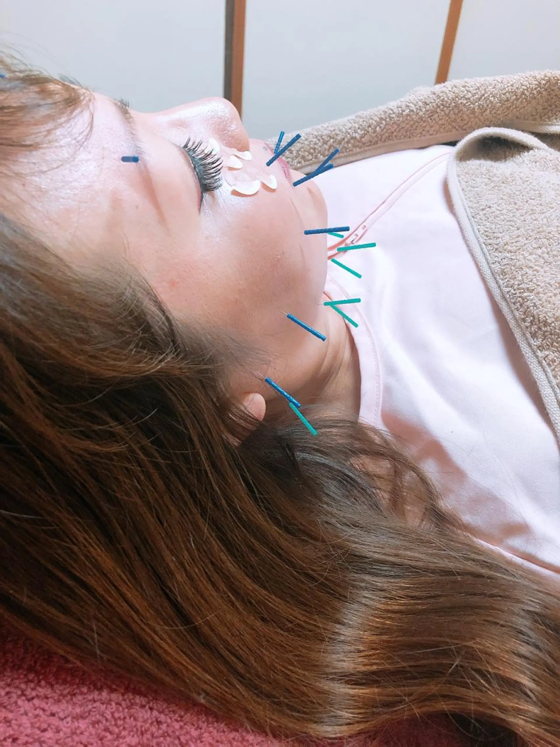 美容鍼灸女性専用 りんご鍼灸治療院のエステ・リラクイメージ