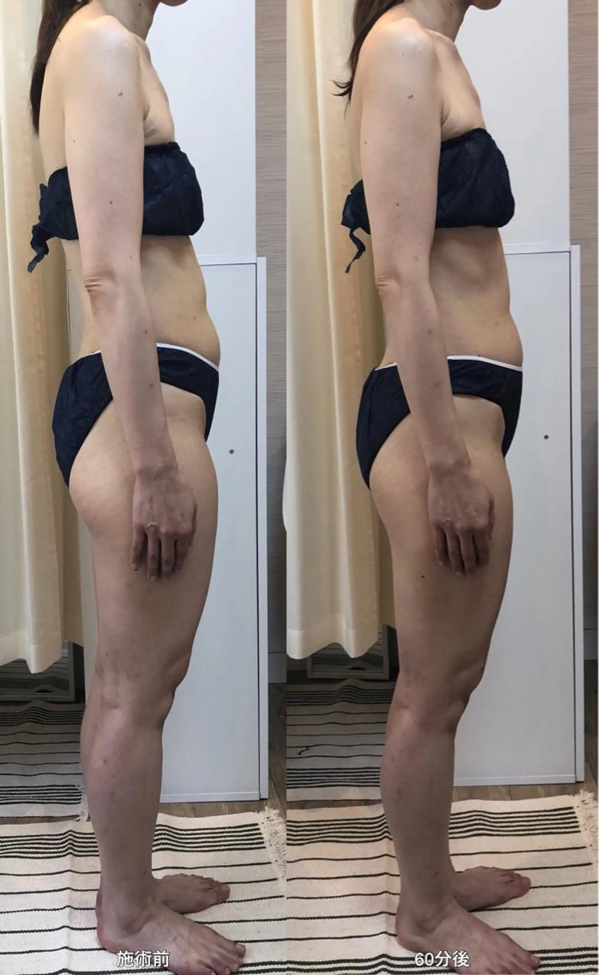 脱毛｜ピーリング ROOM.Sのエステ・リラクイメージ