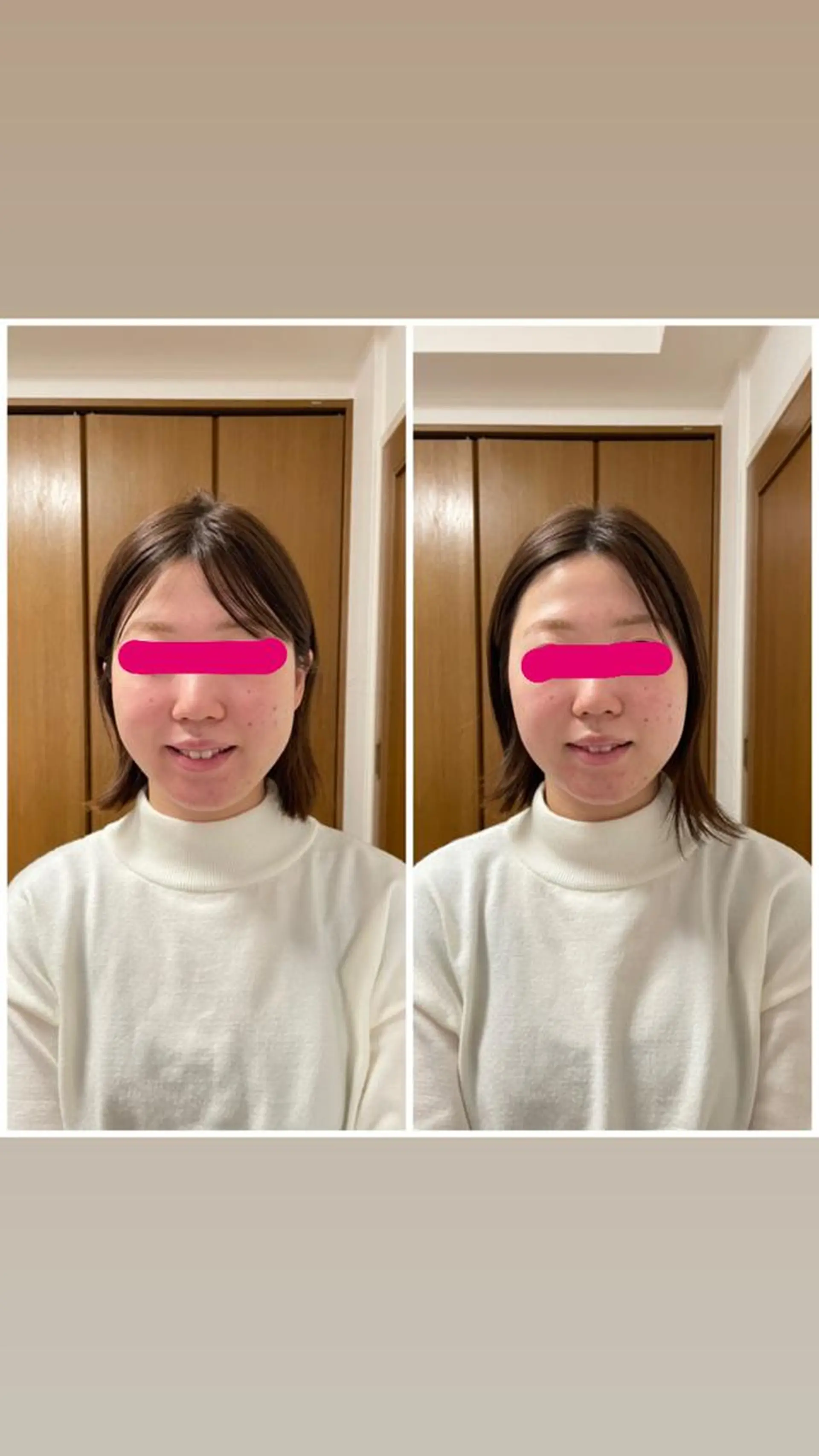 透明感の肌Lino malieのエステ・リラクイメージ