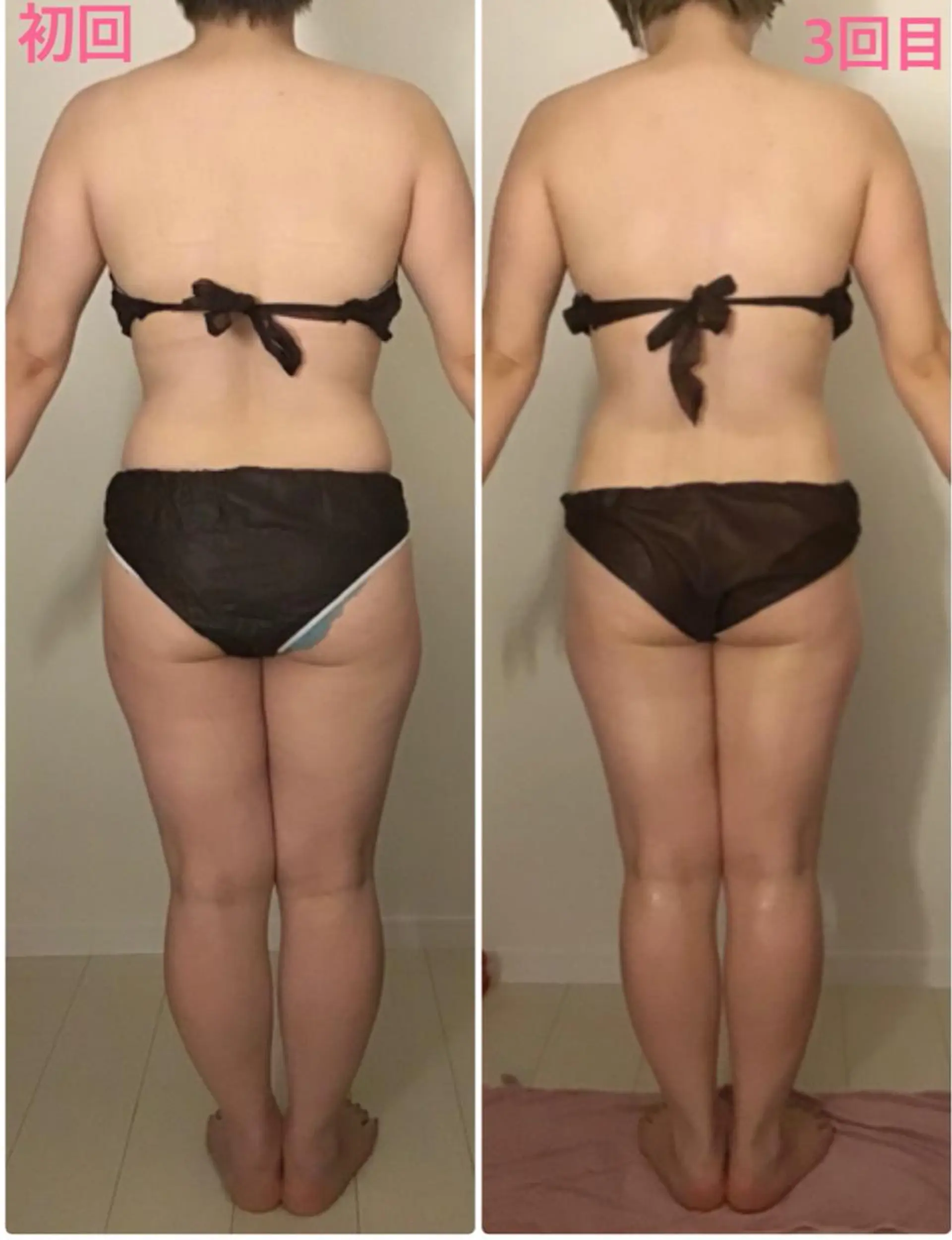 BELLEFINE 💕痩身・小顔・脱毛のエステ・リラクイメージ