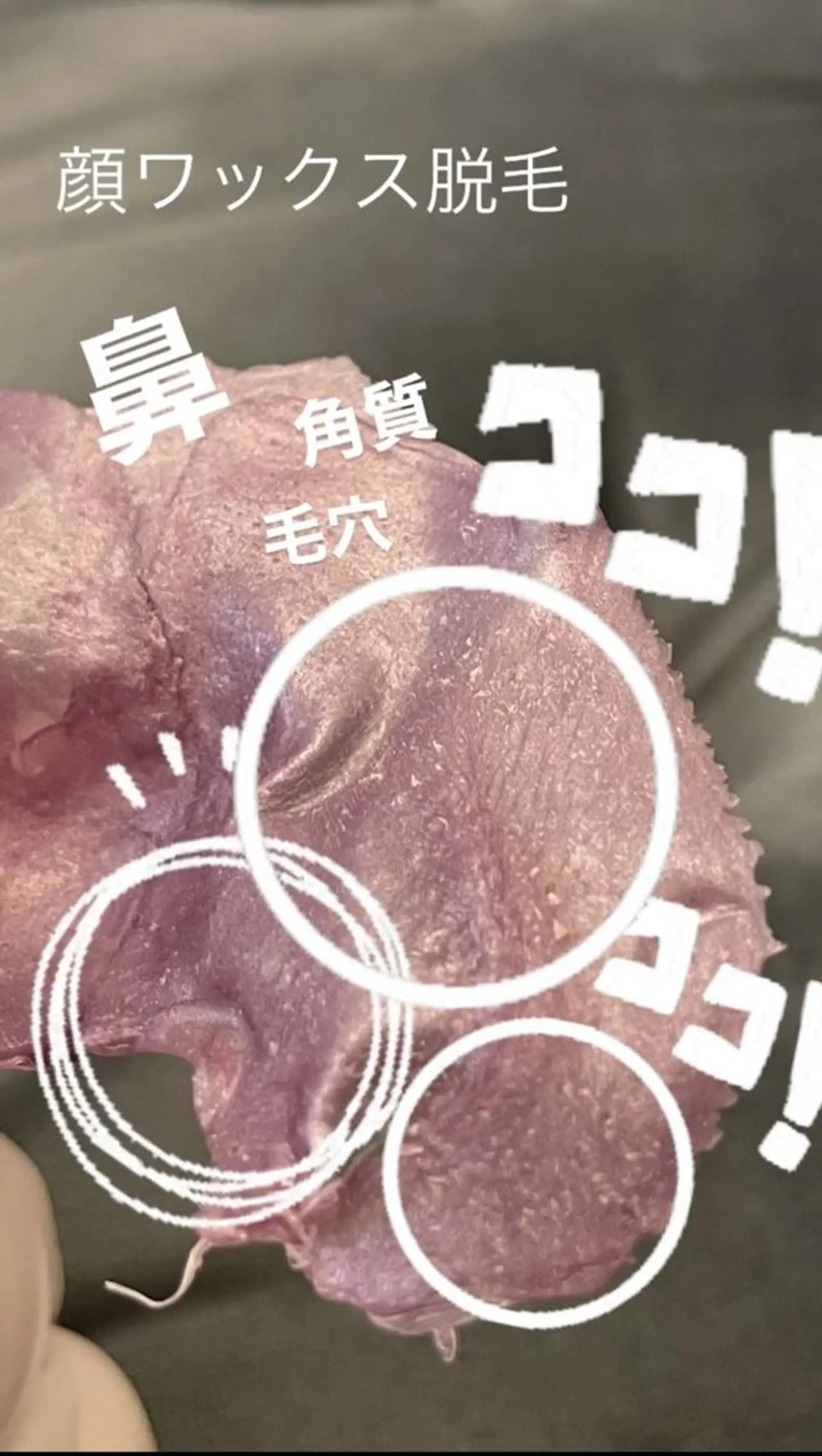 KIRAN 山﨑のエステ・リラクイメージ