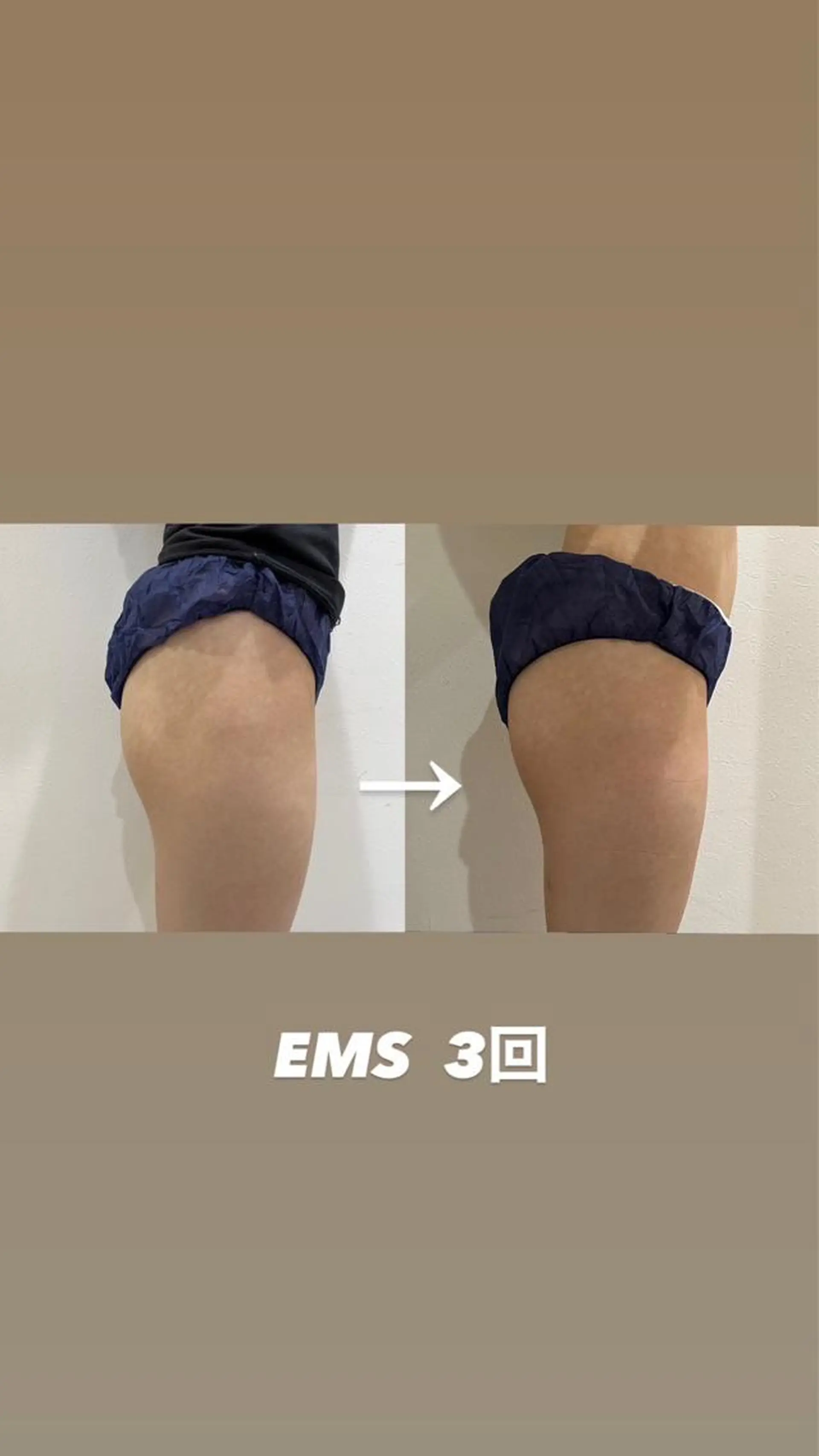 秒速小顔  恵比寿店所属・秒速小顔 恵比寿店 店長 さきのエステ・リラクイメージ