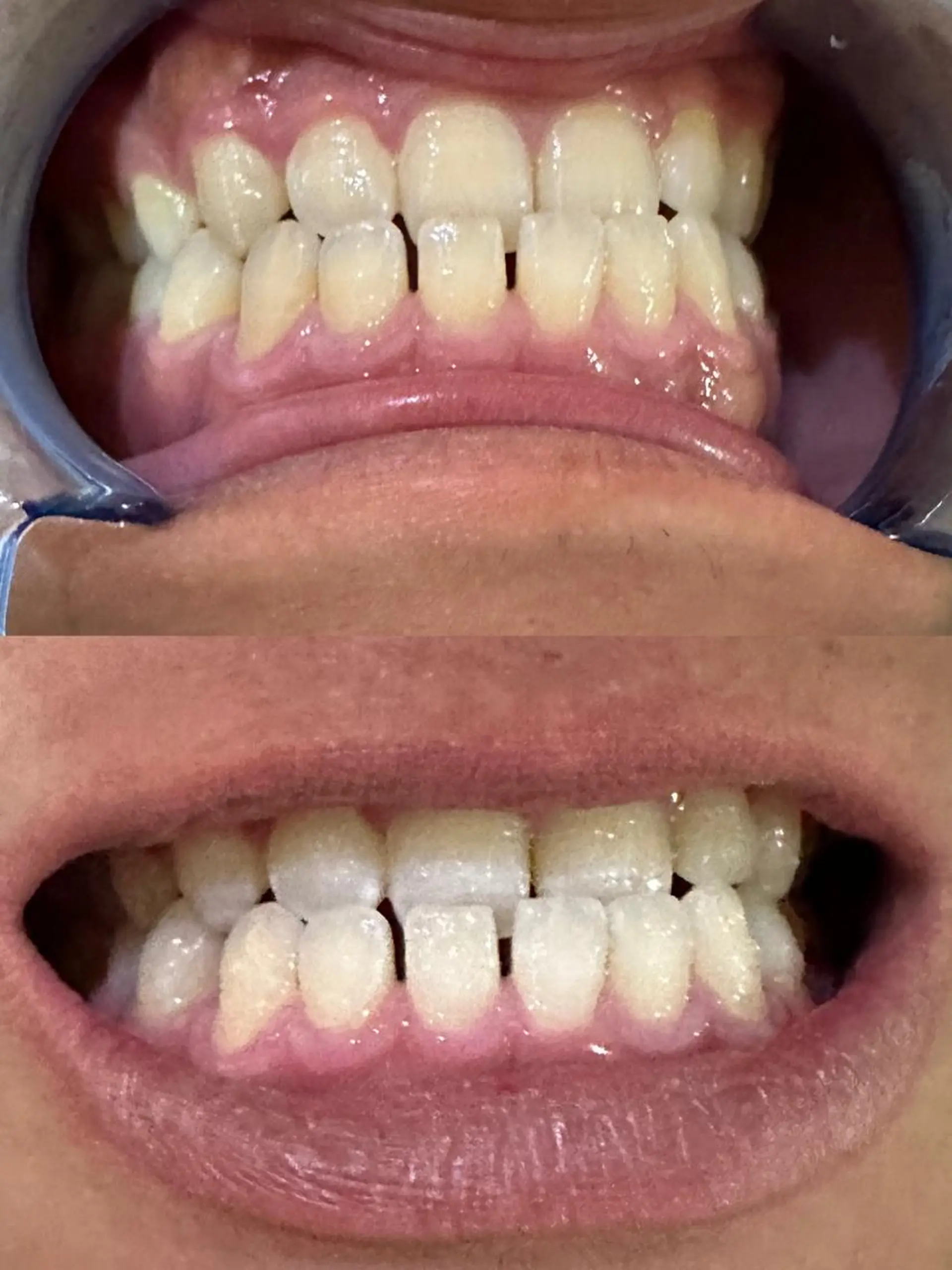 その他 ホワイトニングジム 池袋のその他イメージ