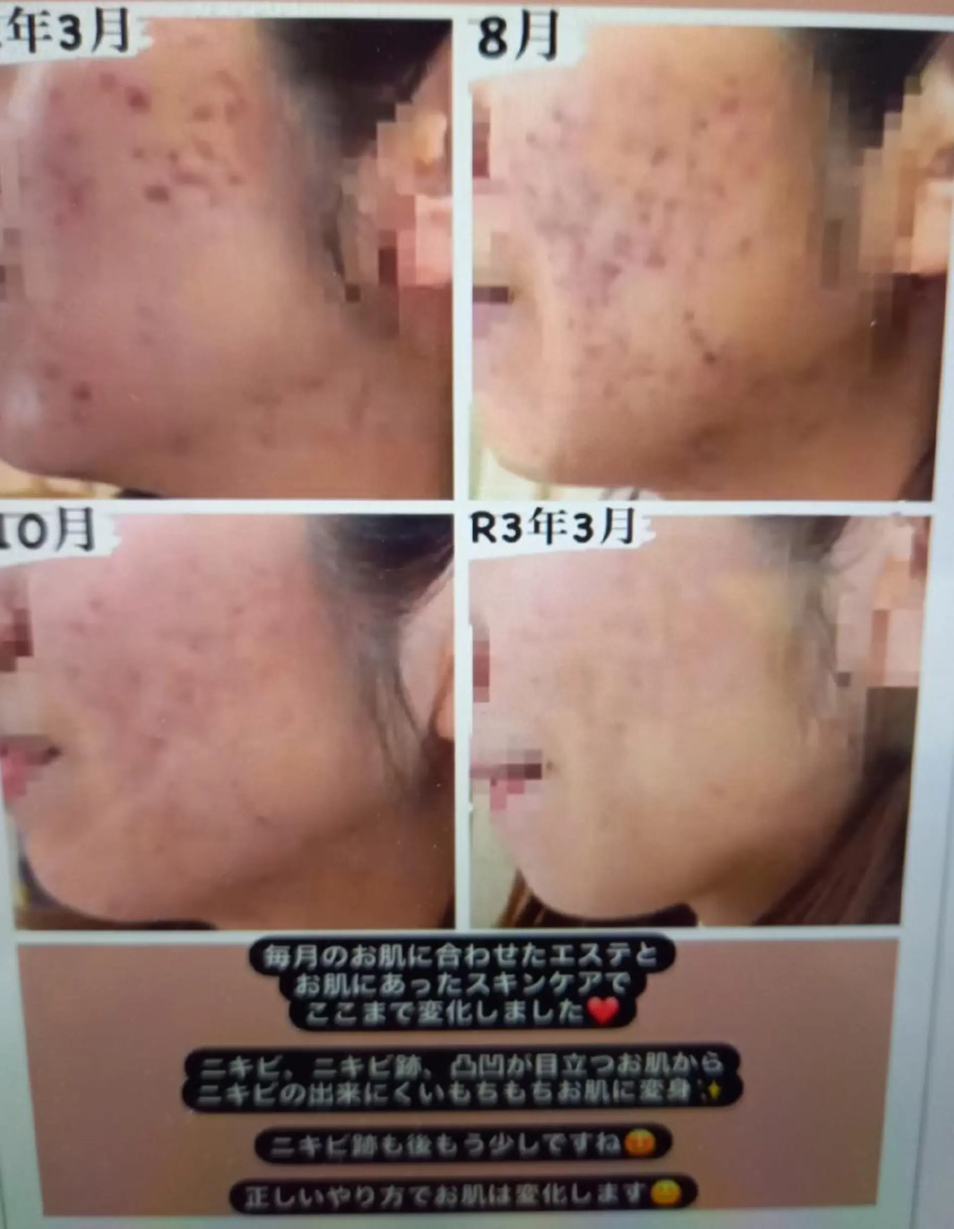 ナリストータルビューティーサロン岐阜所属・辻 恵理のエステ・リラクイメージ