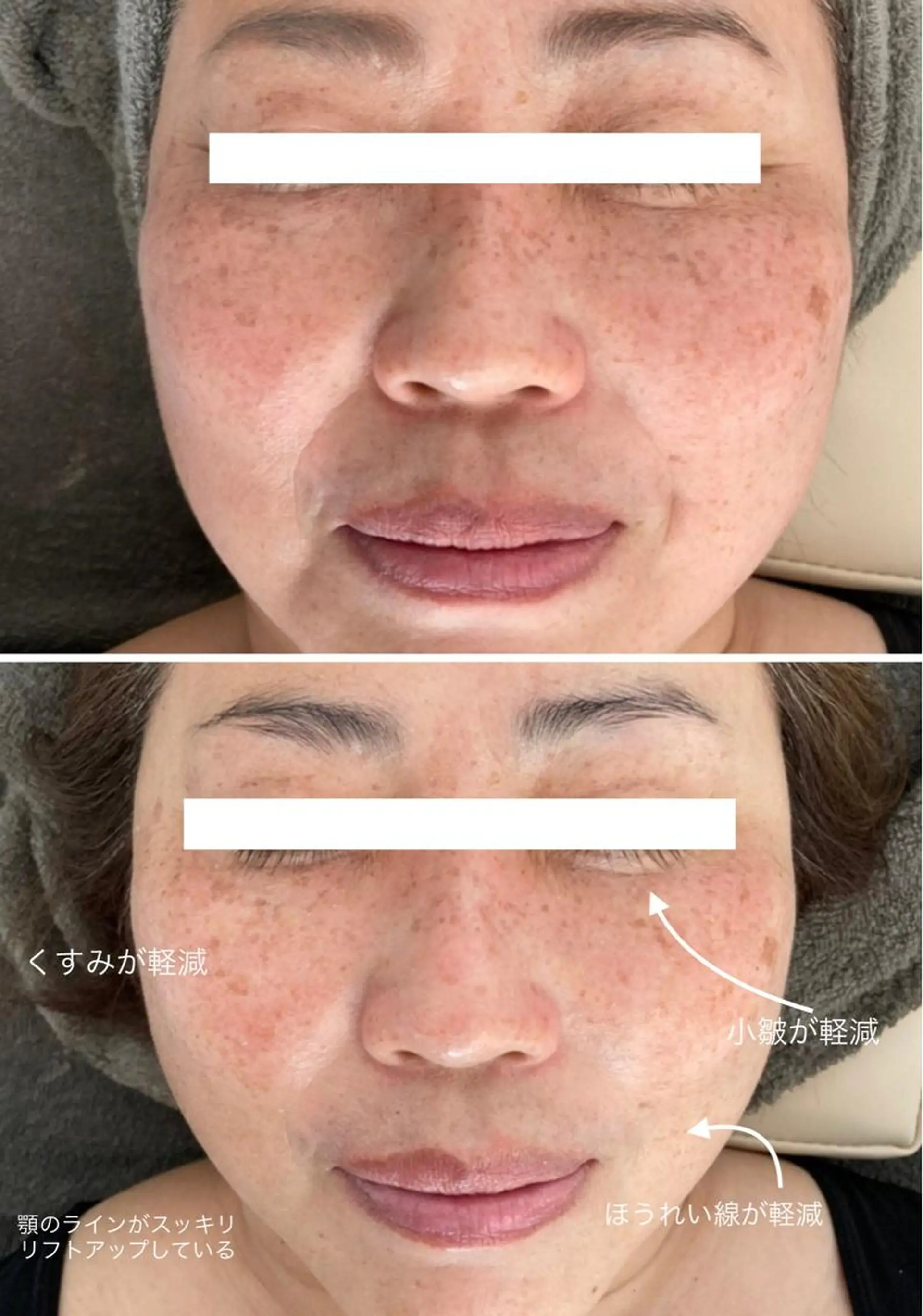 美時雨・bishigure所属・美時雨 bishigureのエステ・リラクイメージ