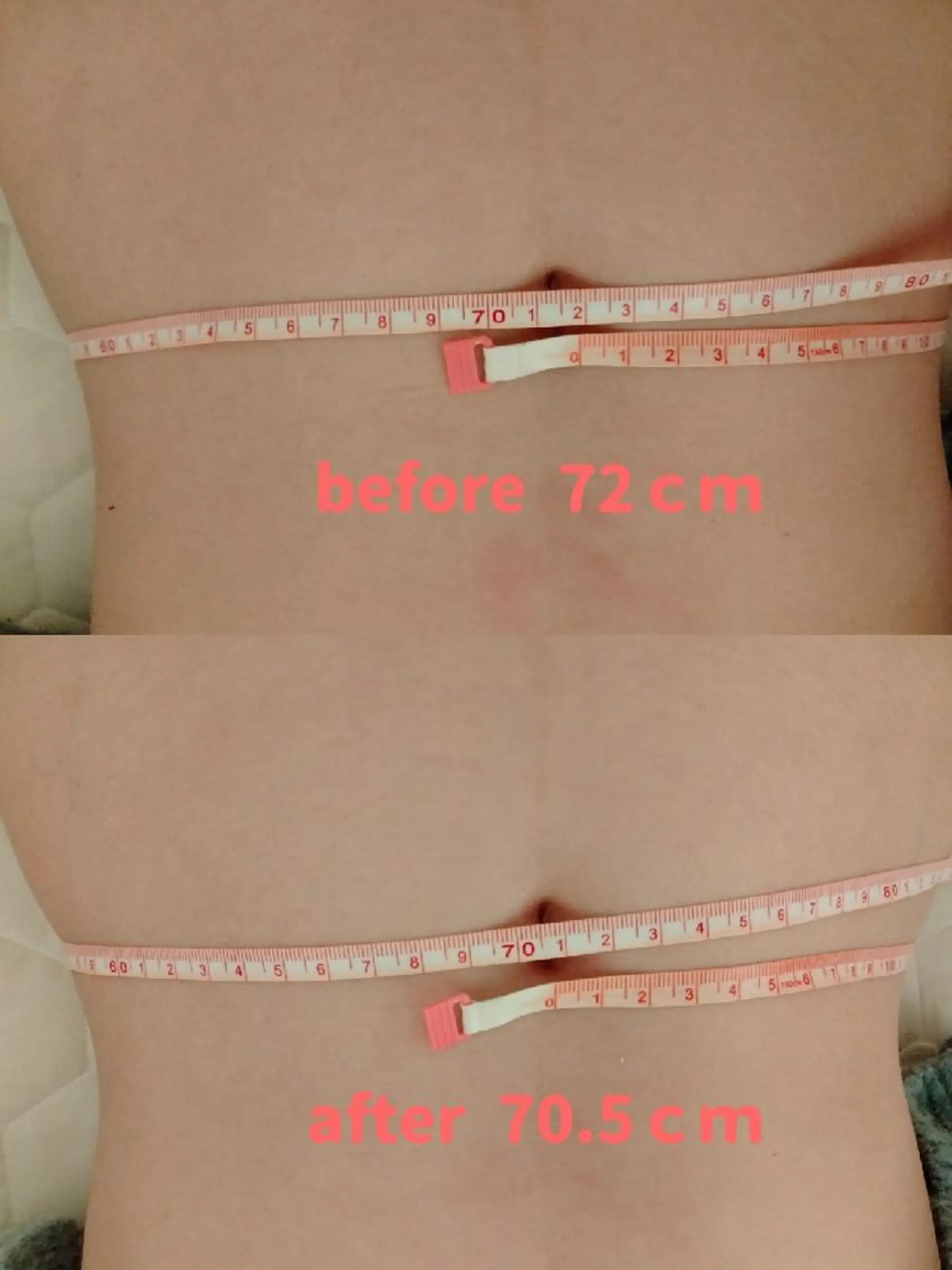 エステ リラク aliaハイフ&水光ジェットサロン所属・aliaハーブ水光店 エステティシャン募集のエステ・リラクイメージ