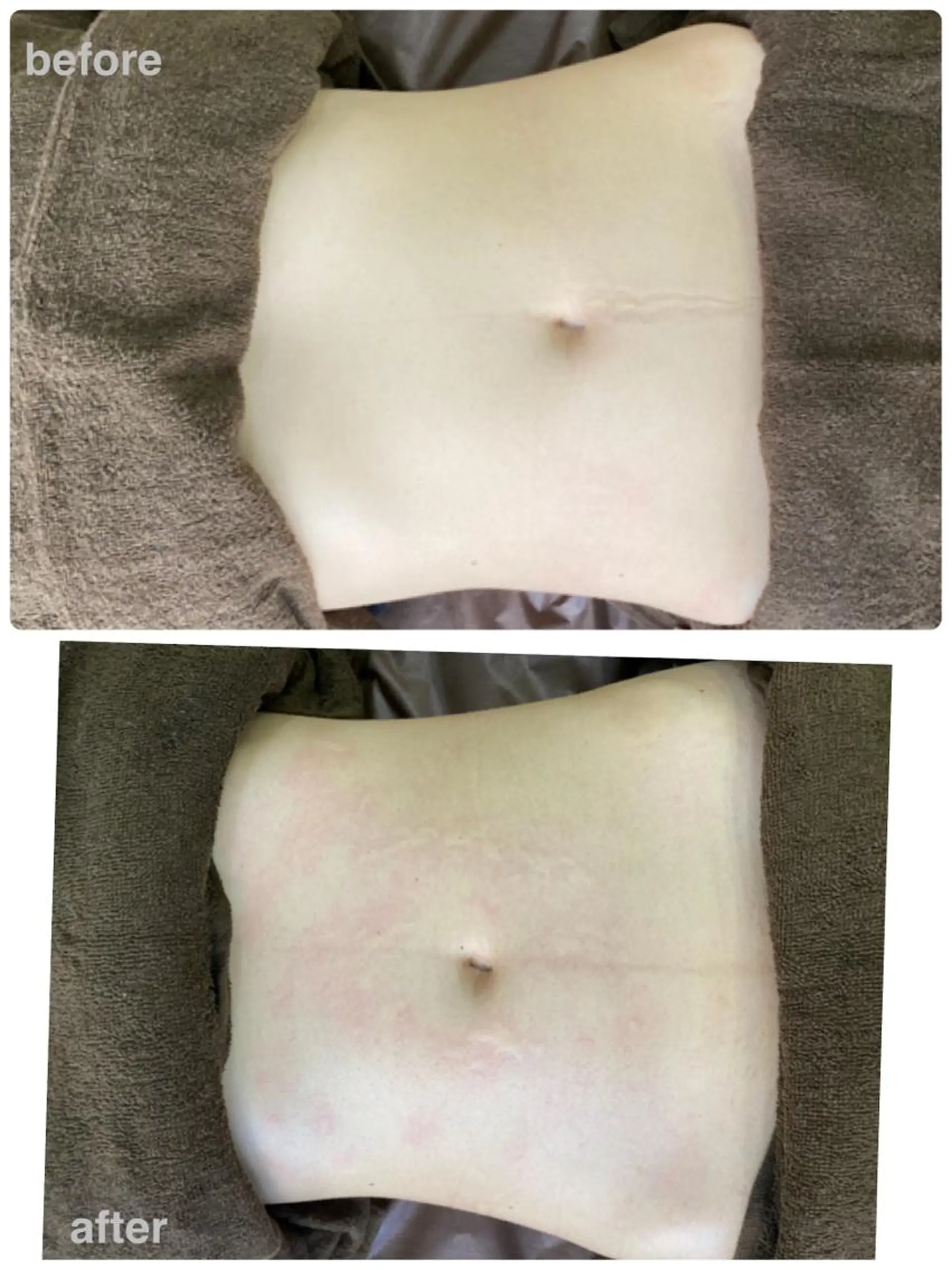 エステ cocorire インターパークの眉毛・アイブロウイメージ