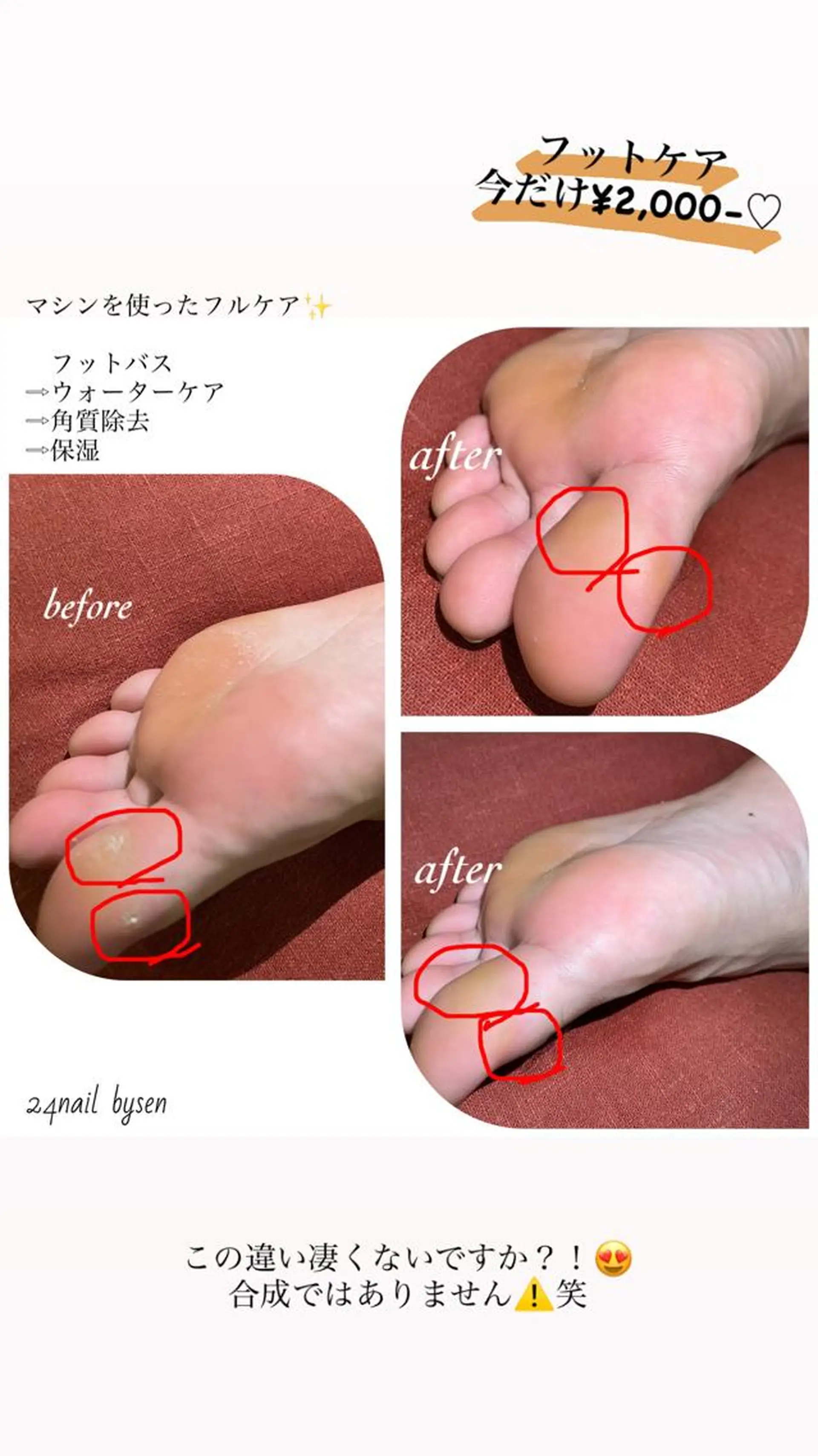 ネイル フットネイル Atelier by 24nail/Ayaのネイルデザイン