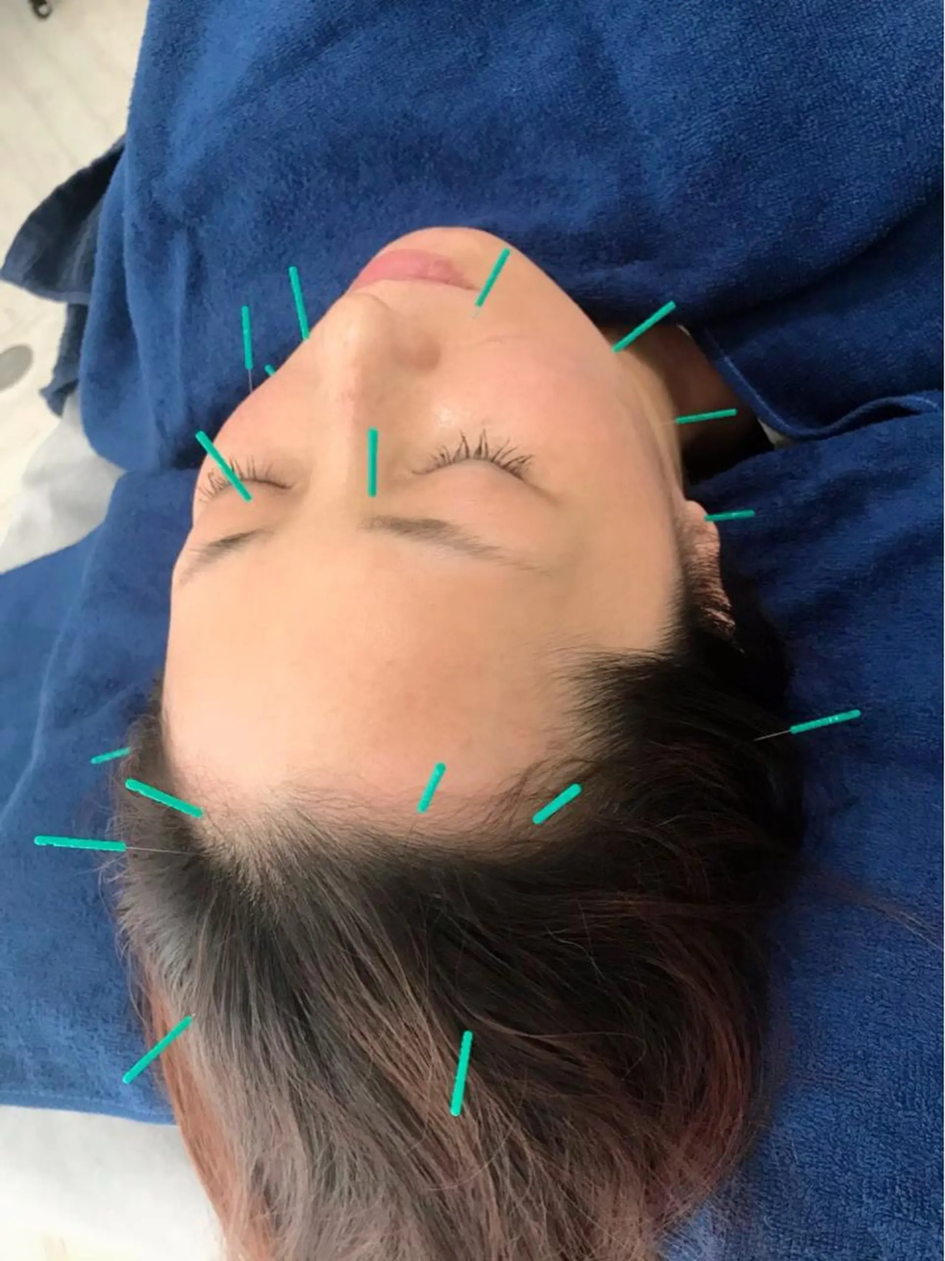 美容鍼灸女性専用 りんご鍼灸治療院のエステ・リラクイメージ