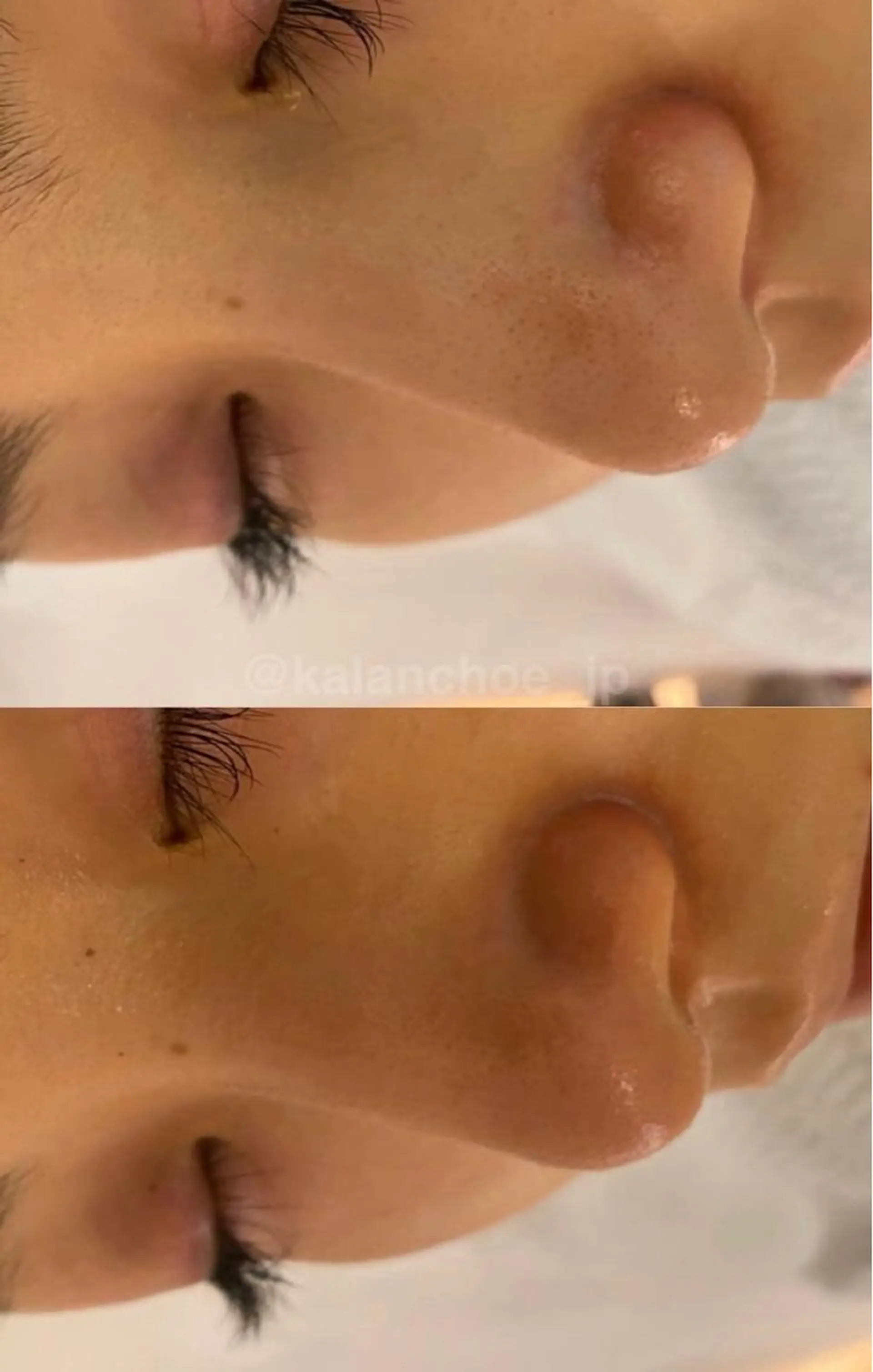 エステ 肌質改善 KALANCHOEのエステ・リラクイメージ