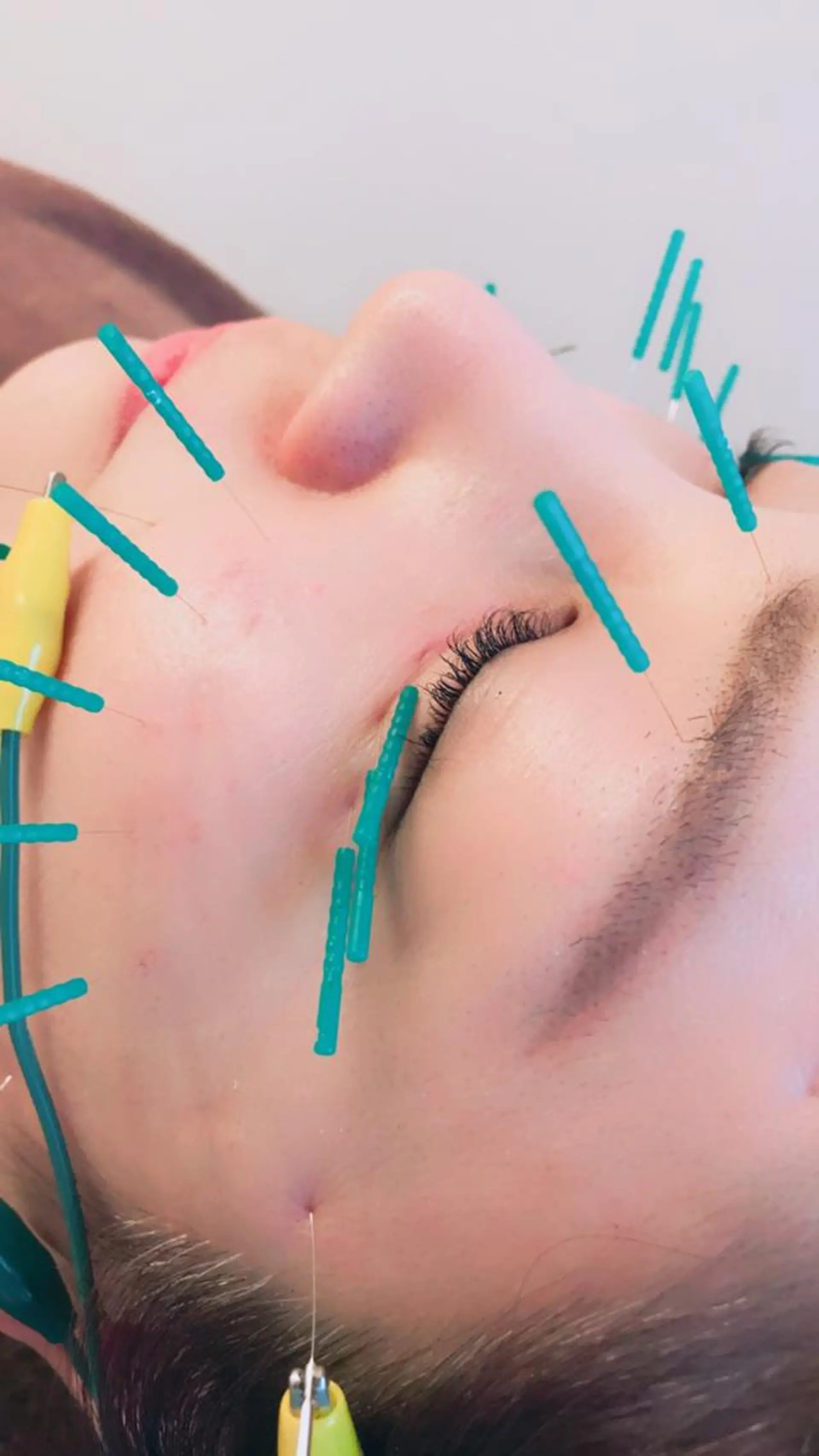 はりすたいる 鍼灸院のエステ・リラクイメージ