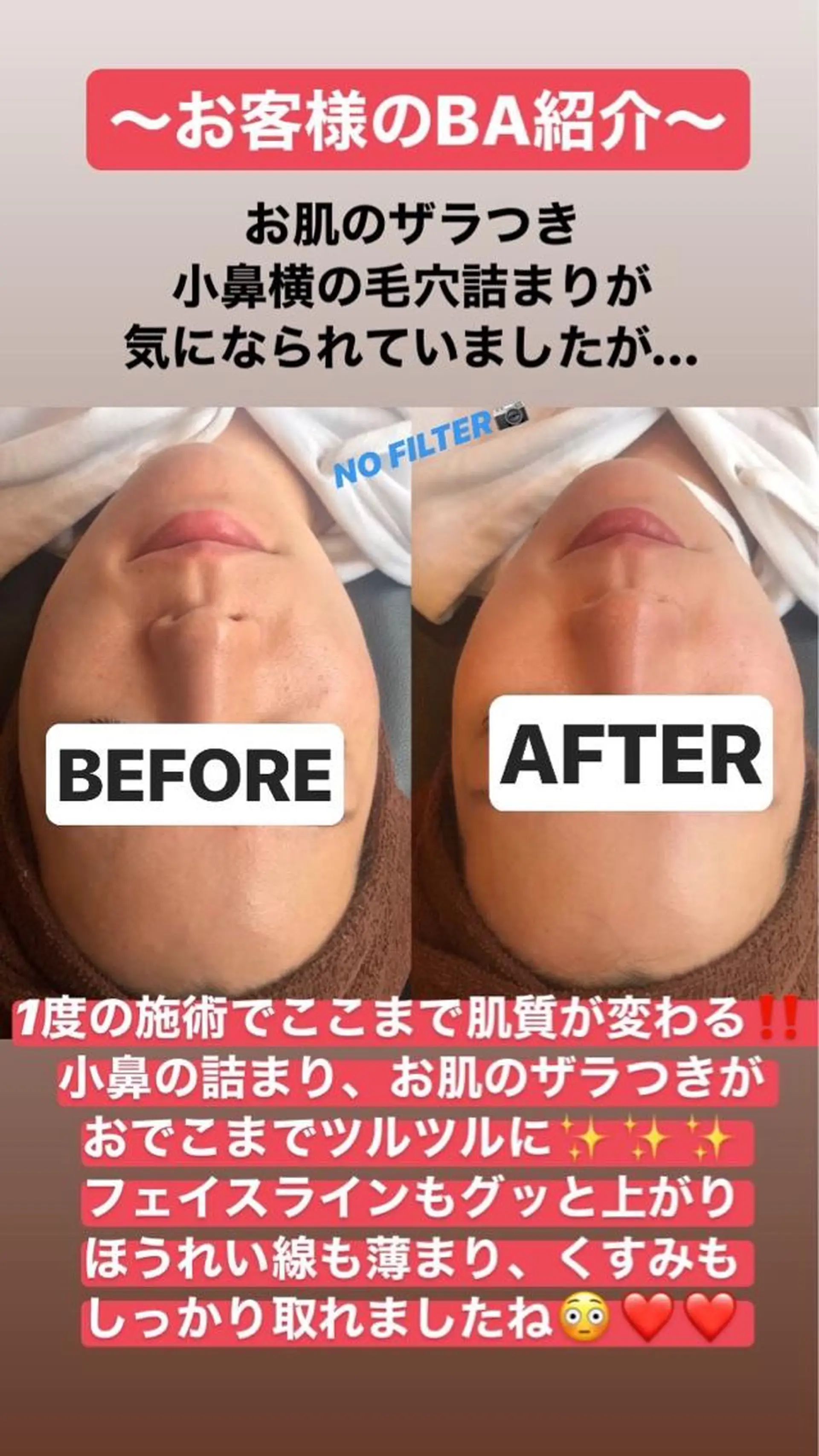 ショート カラー パーマ ヘアアレンジ メンズ キッズ ネイル マツエク・マツパ NANIOAFU [本町店]のその他イメージ