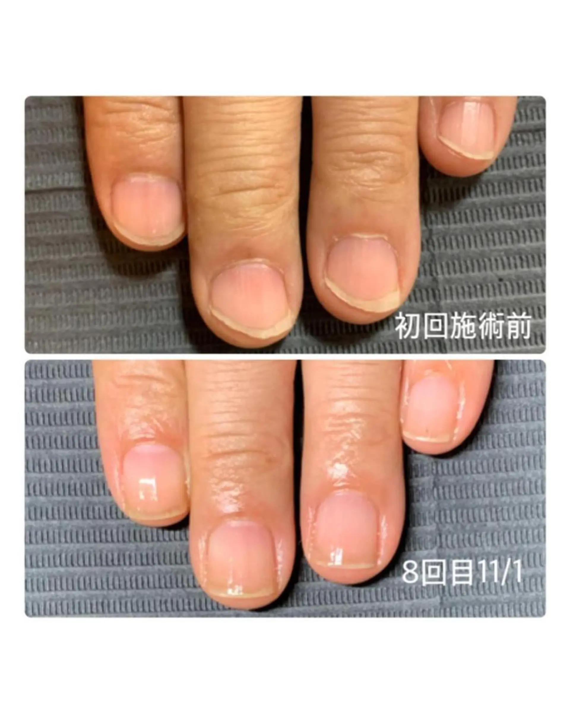 ネイル TiALASH ＊Kozue＊のネイルデザイン