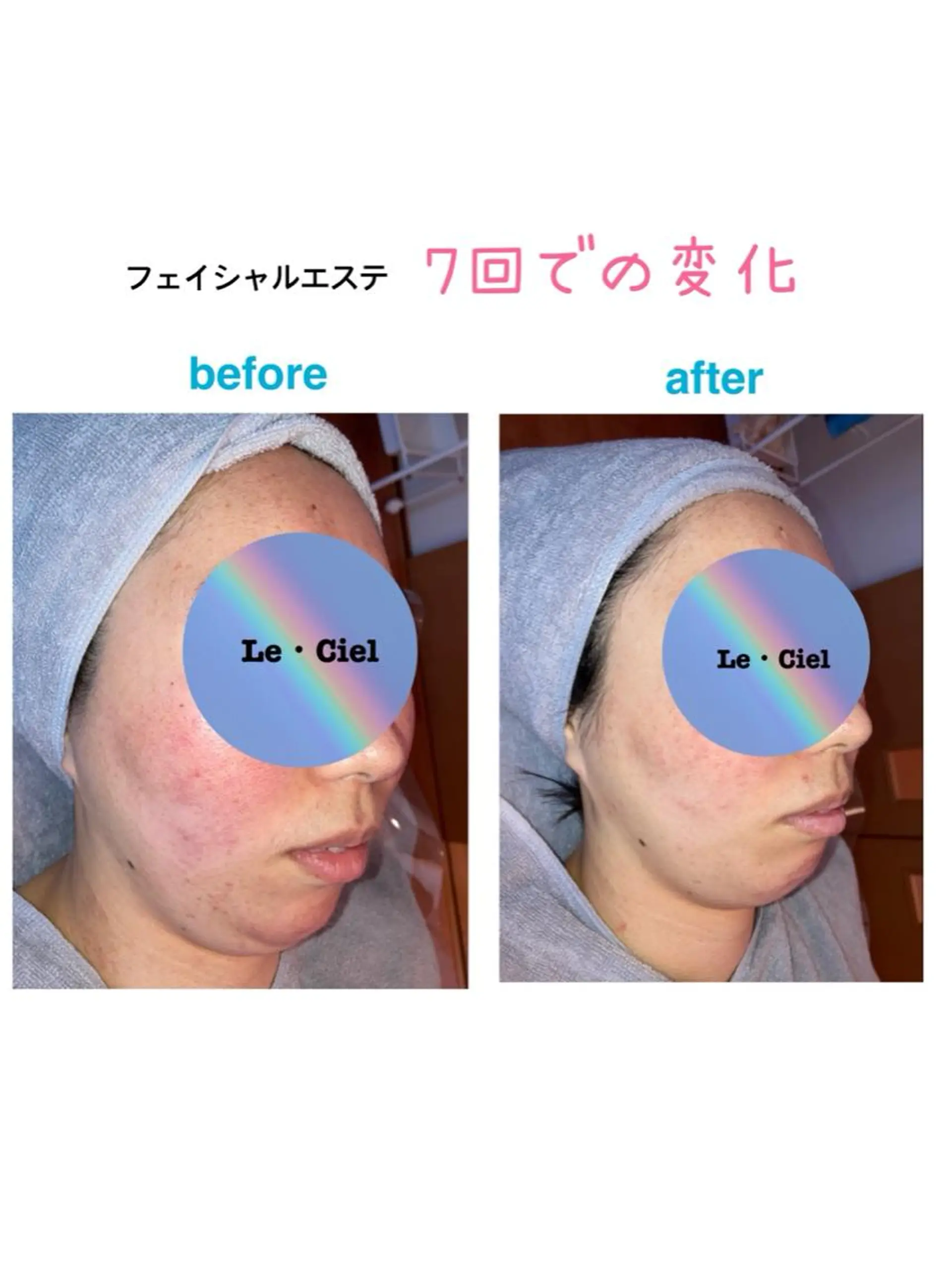 フェイシャルエステLe・Ciel所属・Le・Ciel フェイシャル&ボディのエステ・リラクイメージ