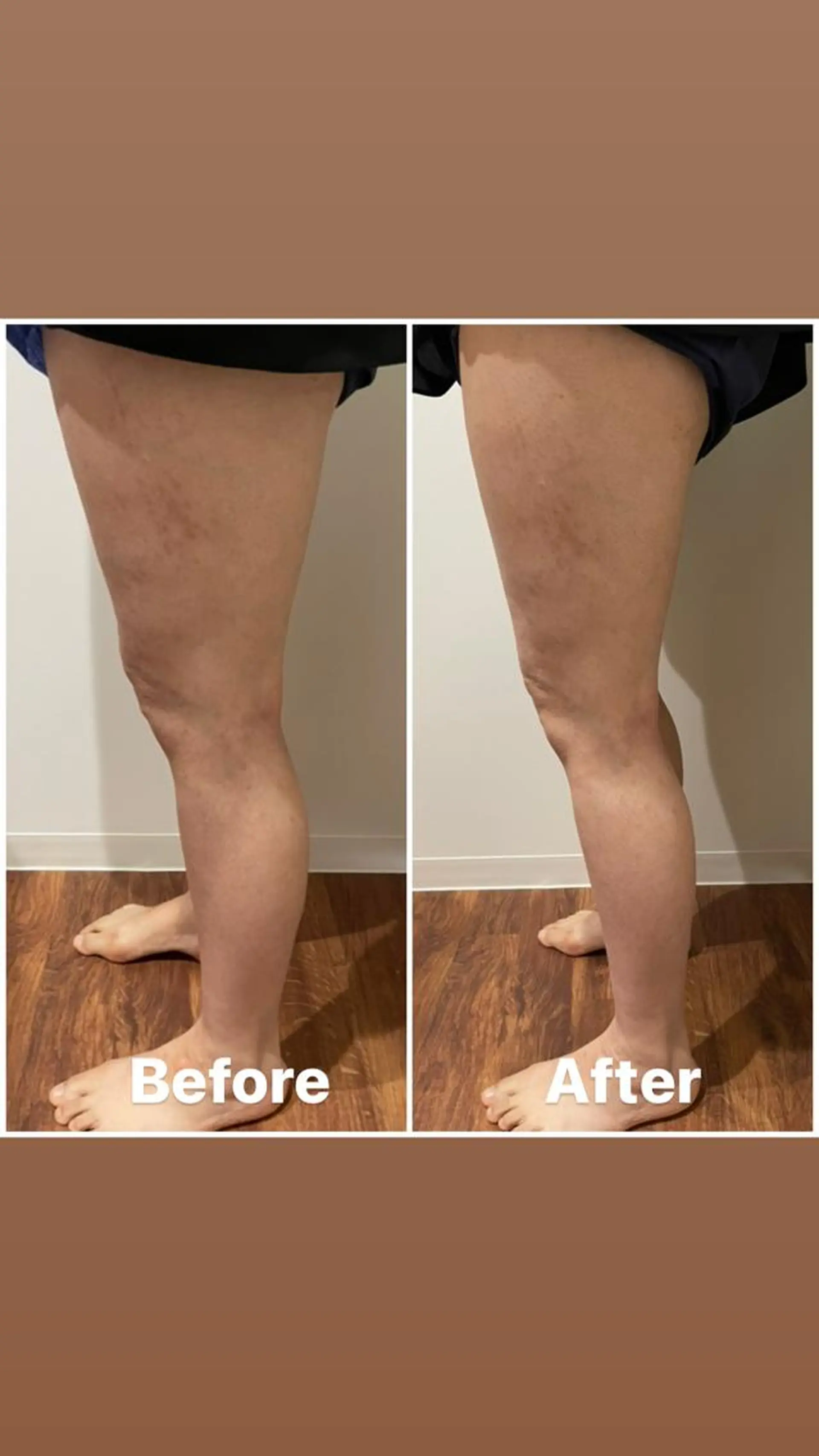 nina《快眠ドライヘッドスパ＆ボディーリンパケア》所属・nina 野沢あゆみのエステ・リラクイメージ