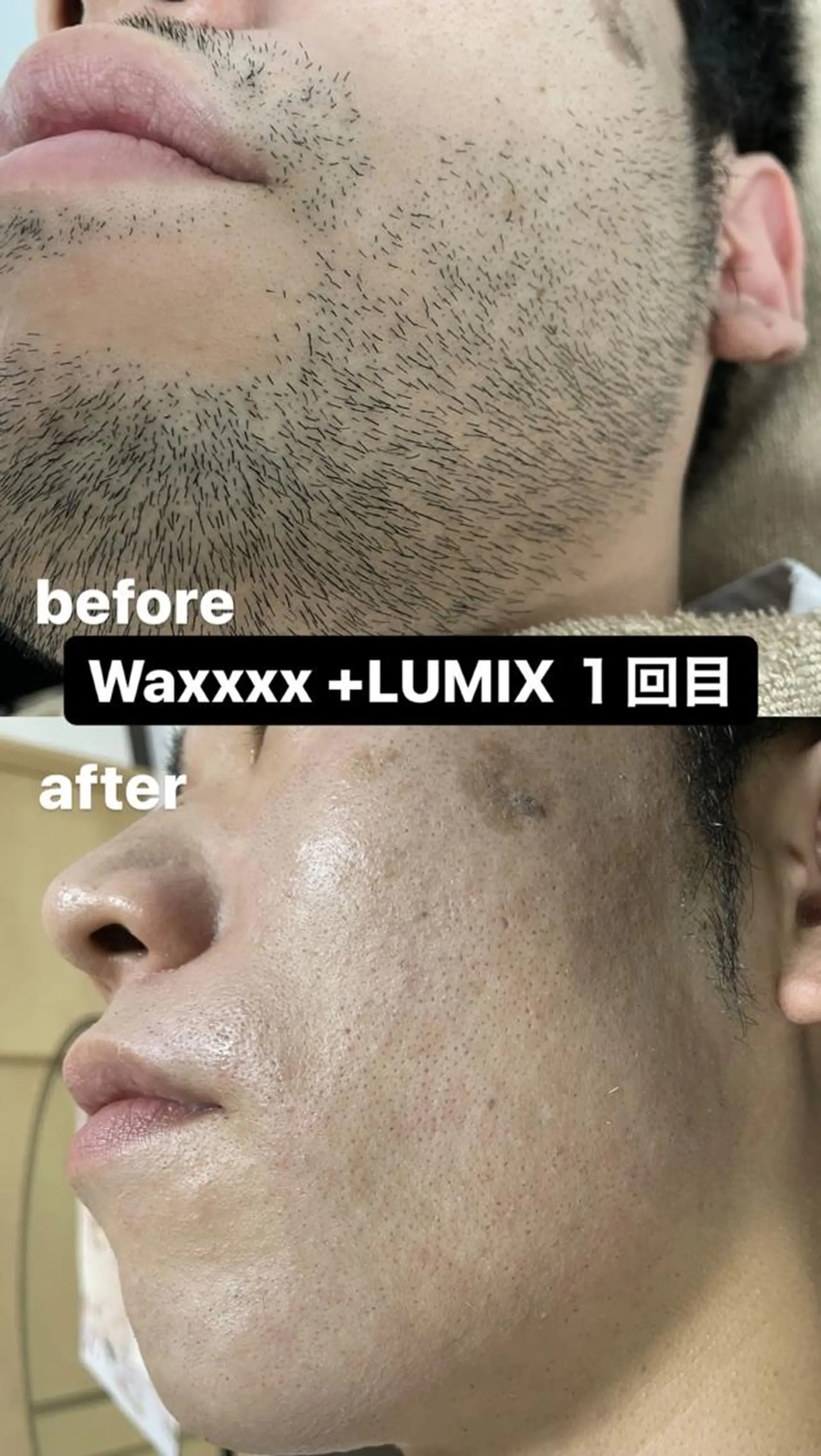 メンズ 脱毛 Epina 千葉店 【エピナ】のエステ・リラクイメージ