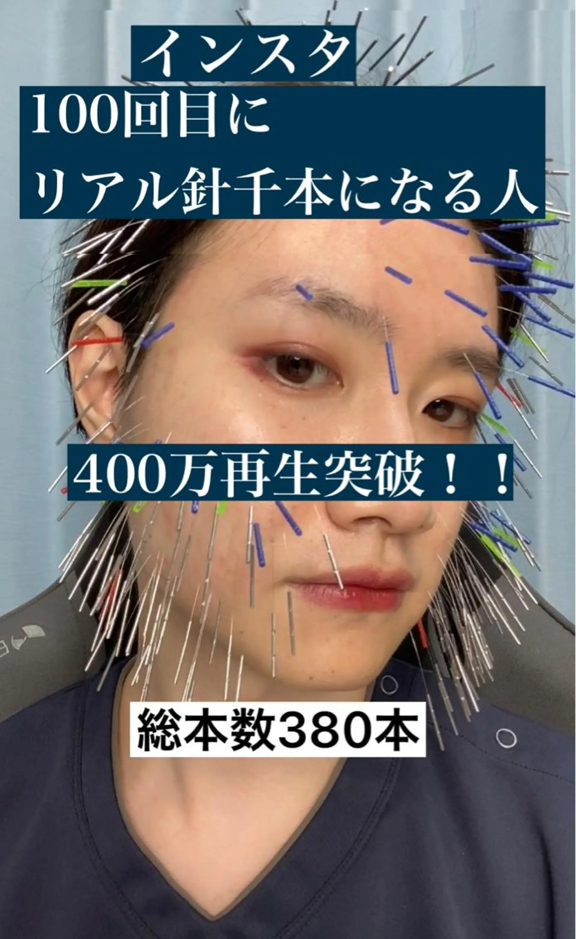 美容鍼・小顔矯正 ハリシェンドのエステ・リラクイメージ