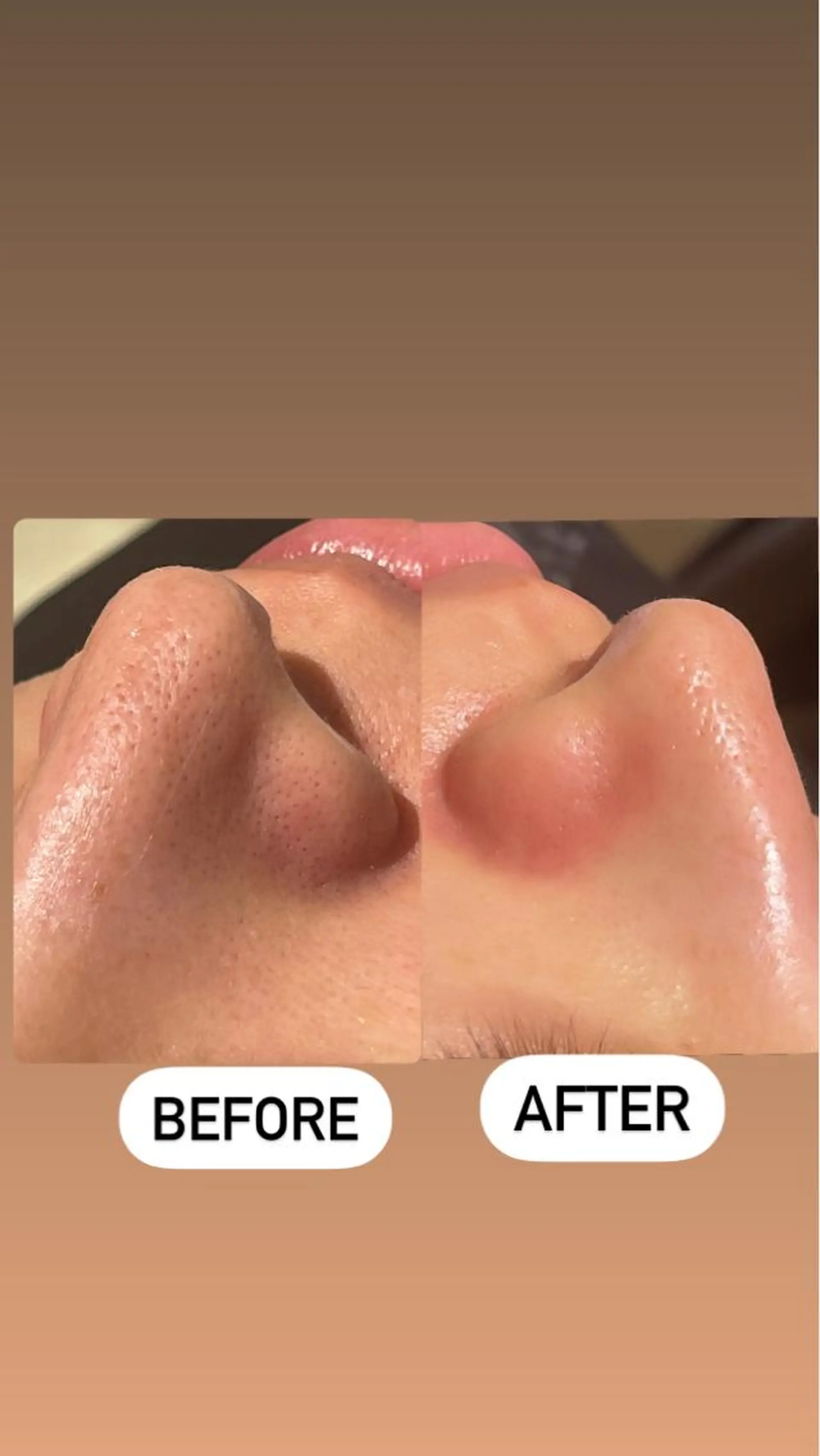 エステ リラク メンズ眉毛ITSUK Iメンズ専門　新宿の眉毛・アイブロウイメージ