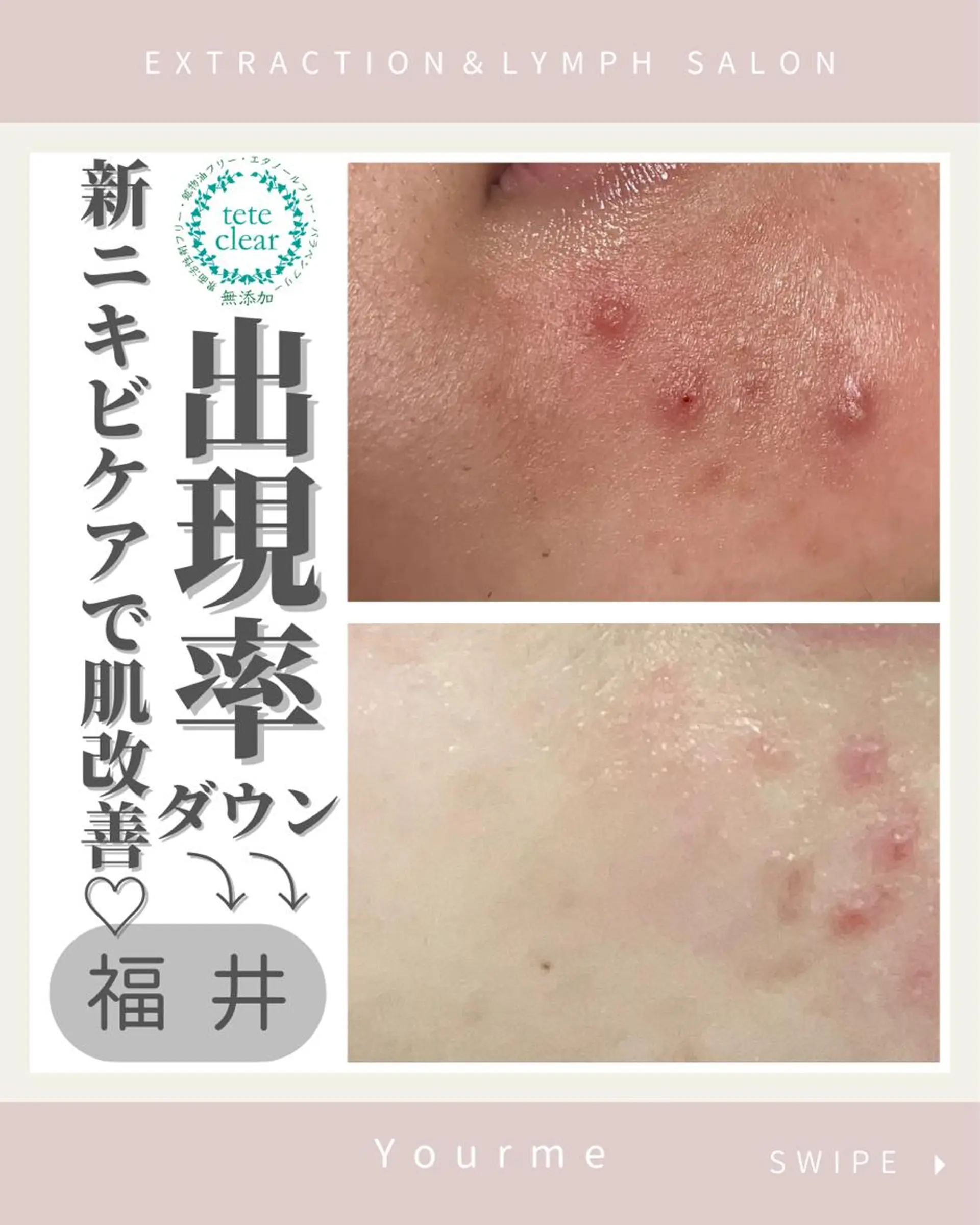 毛穴肌質ケアサロン Yourmeユアミーのエステ・リラクイメージ