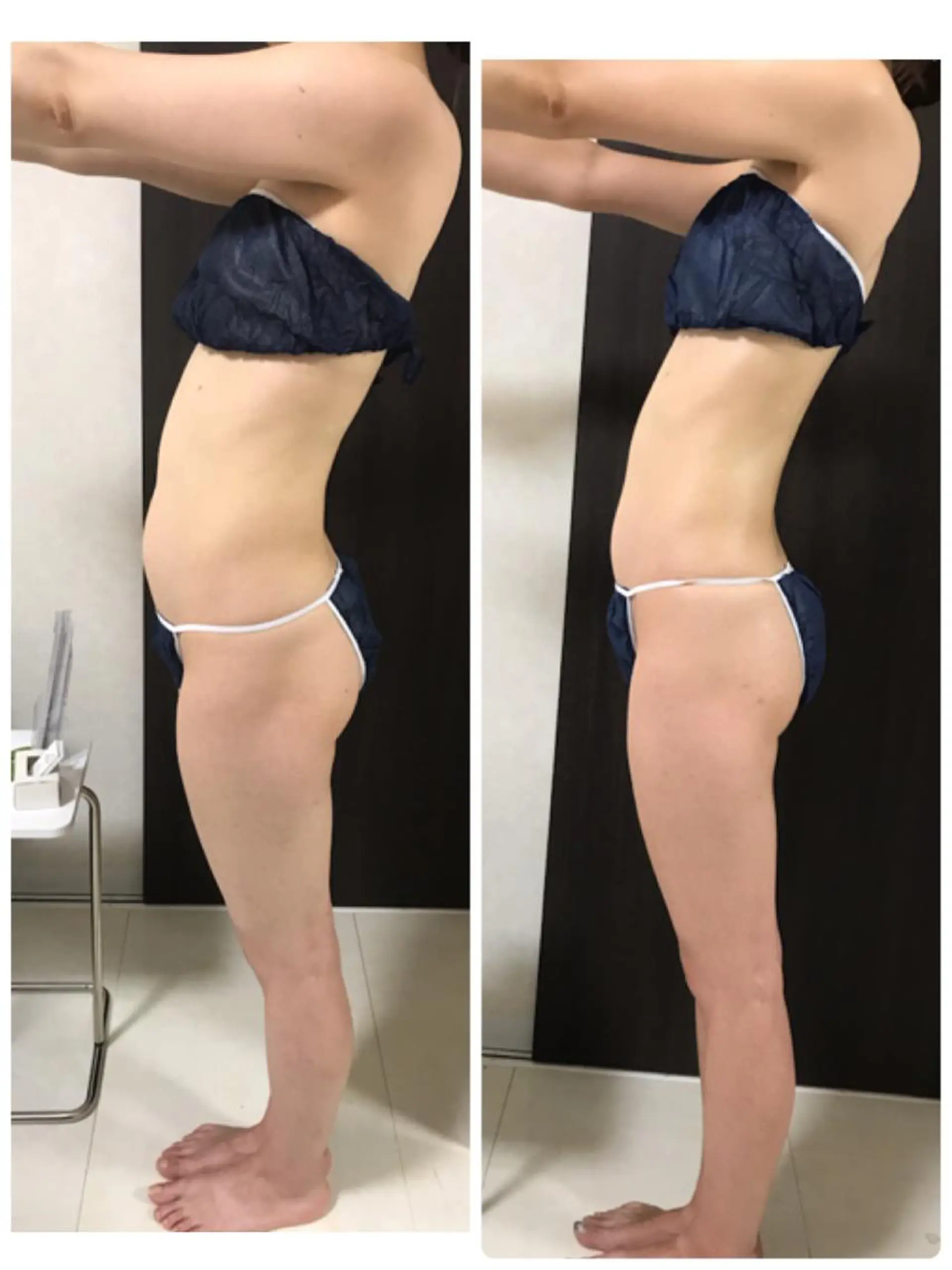 その他 ダイエット／脱毛 美顔／フォト／ハーブのその他イメージ