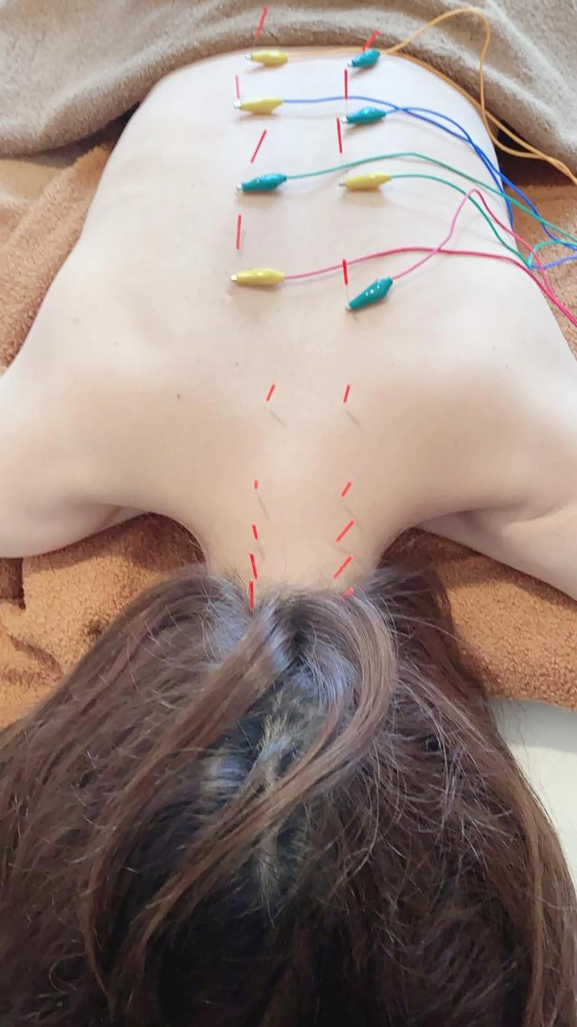 さや 鍼灸院のその他イメージ