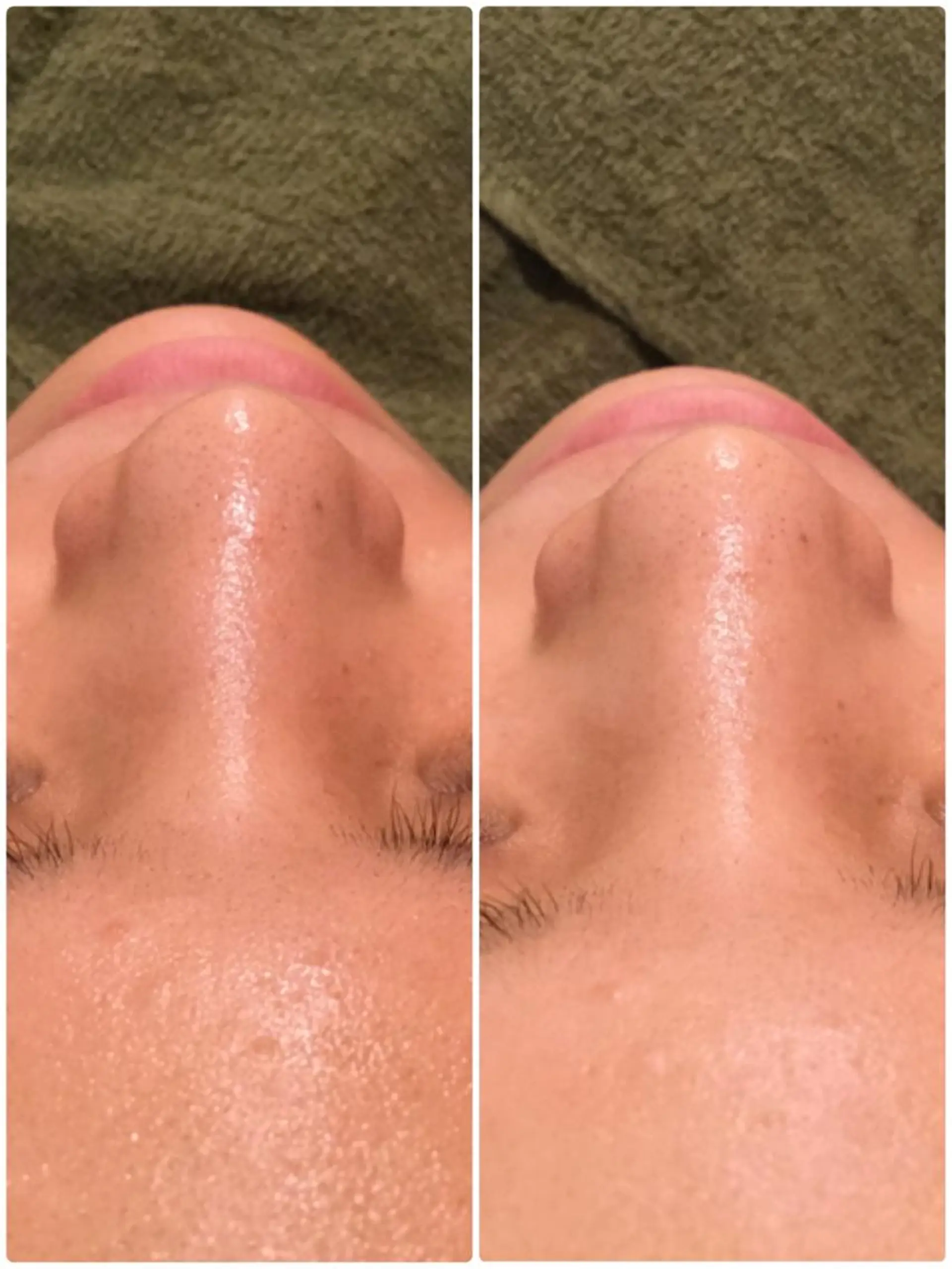 エステ 【リベルハーブピーリング認定店】敏感肌・美白脱毛専門店Dione立川店所属・Dione 立川店のエステ・リラクイメージ