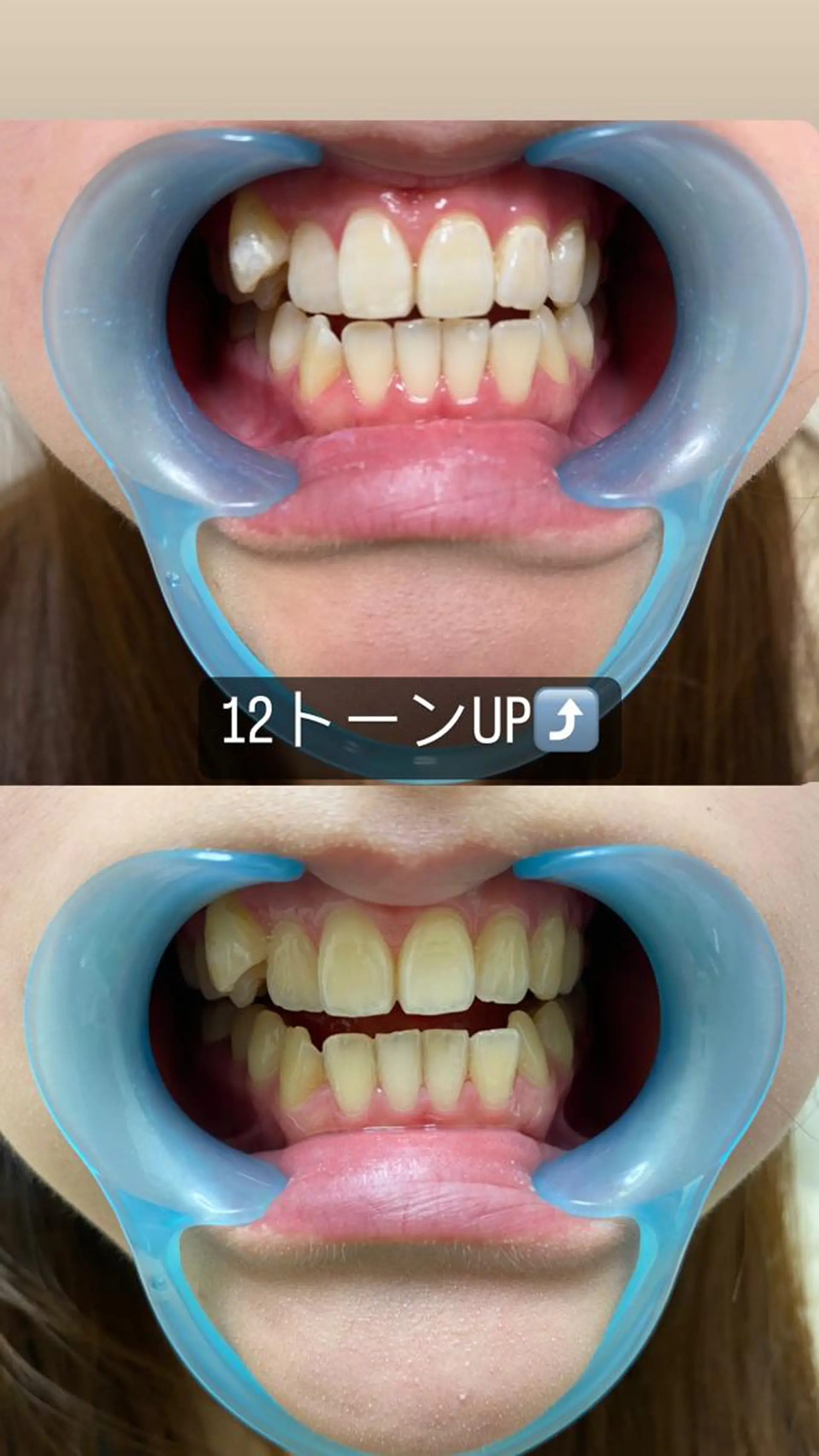 メンズ アイブロウ セルフホワイトニング White33大名のその他イメージ