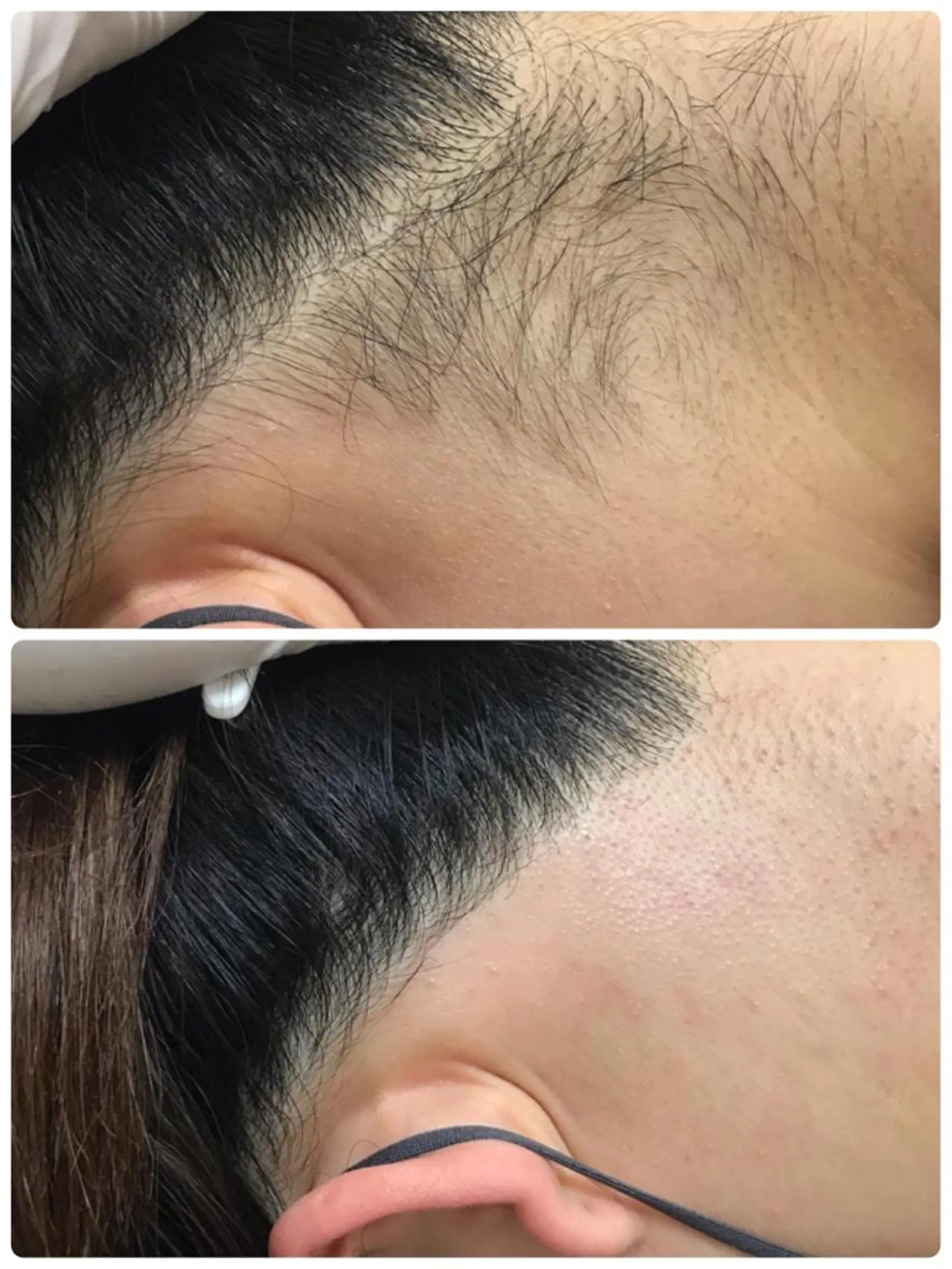 脱毛 MAKANA waxing&relaxation所属・MAKANA 吉岡 小岩店の眉毛・アイブロウイメージ