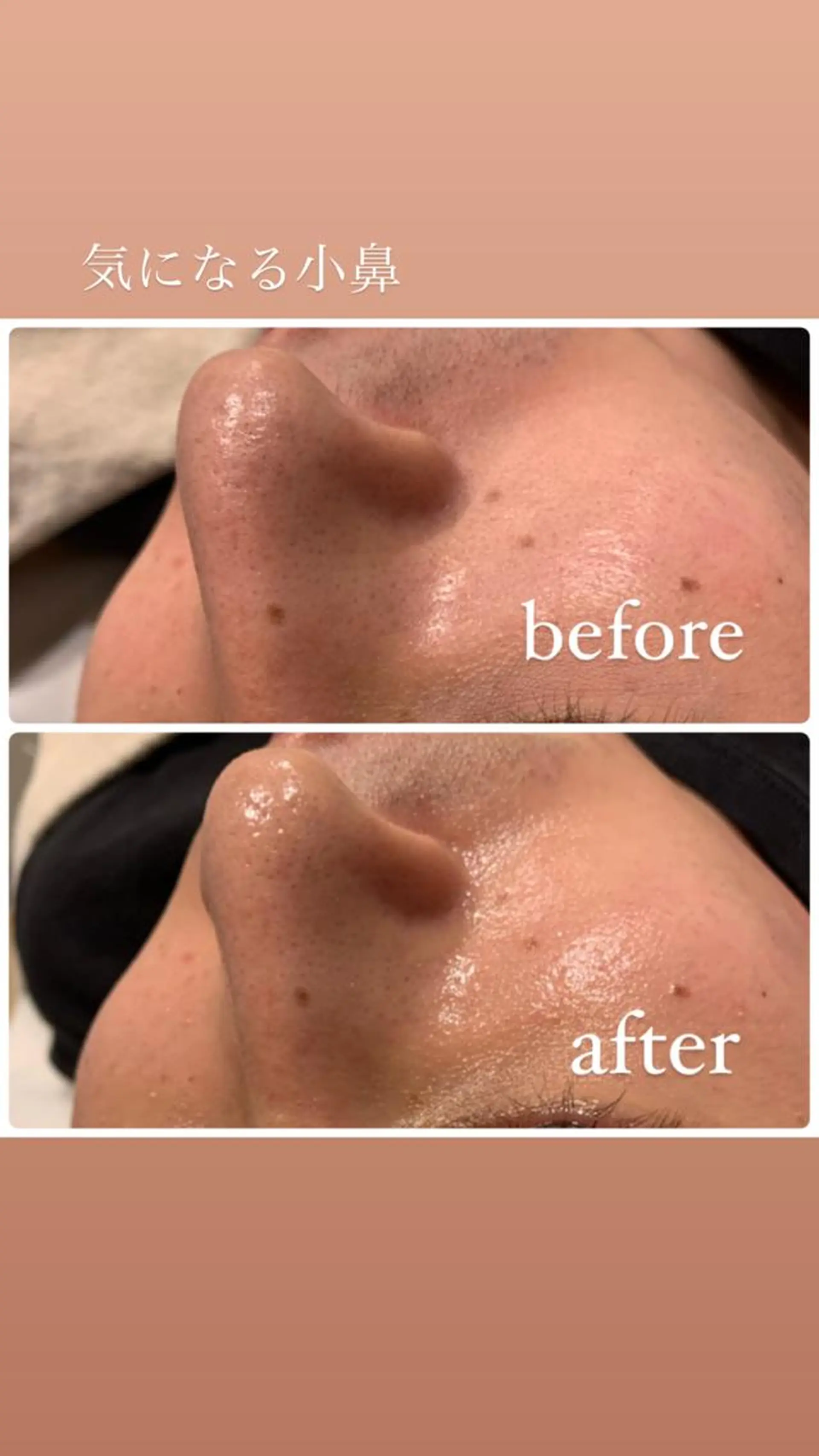 その他 種市 貴子のその他イメージ