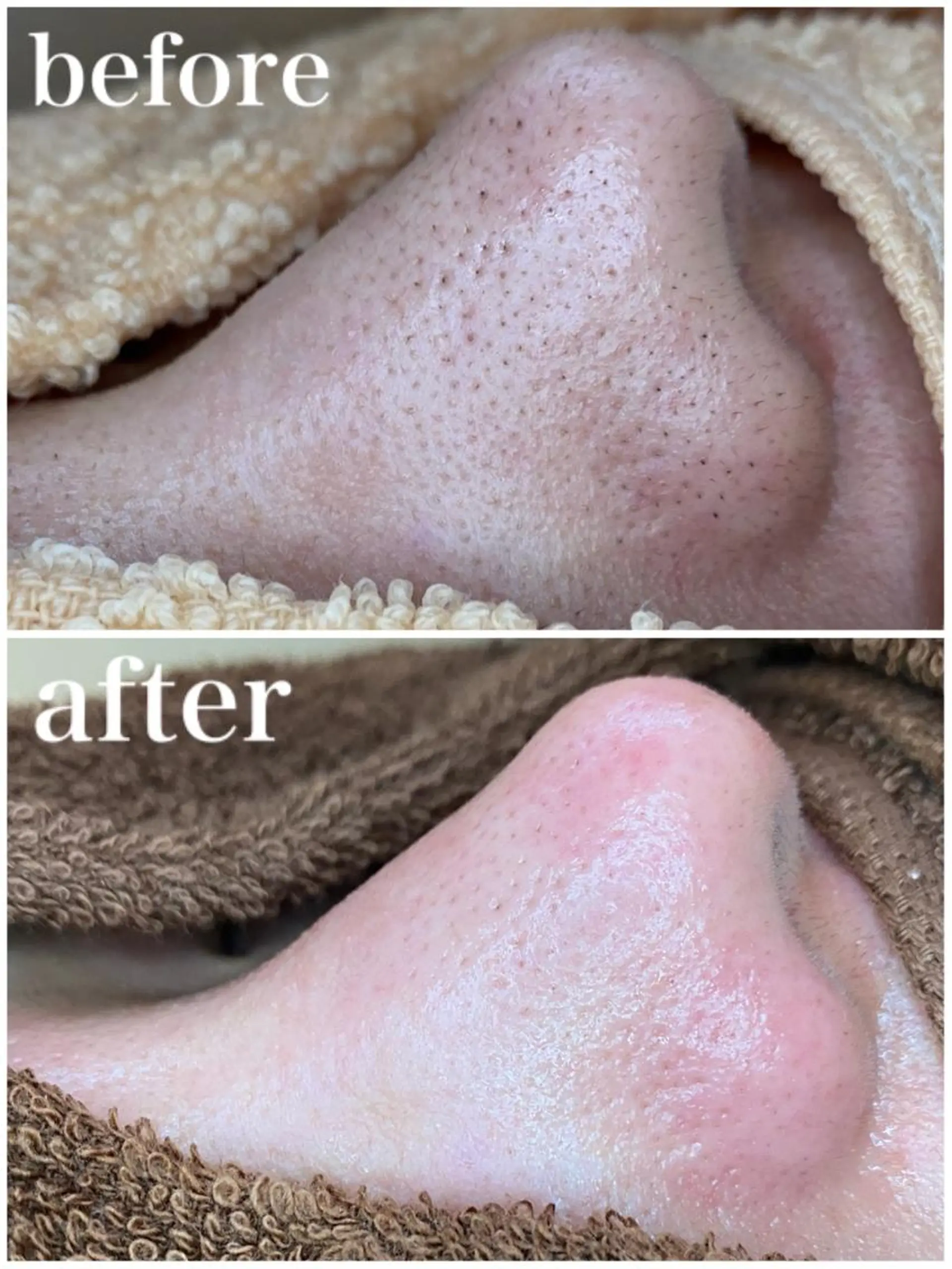 エステ リラク 韓国肌管理 【毛穴専科】のエステ・リラクイメージ