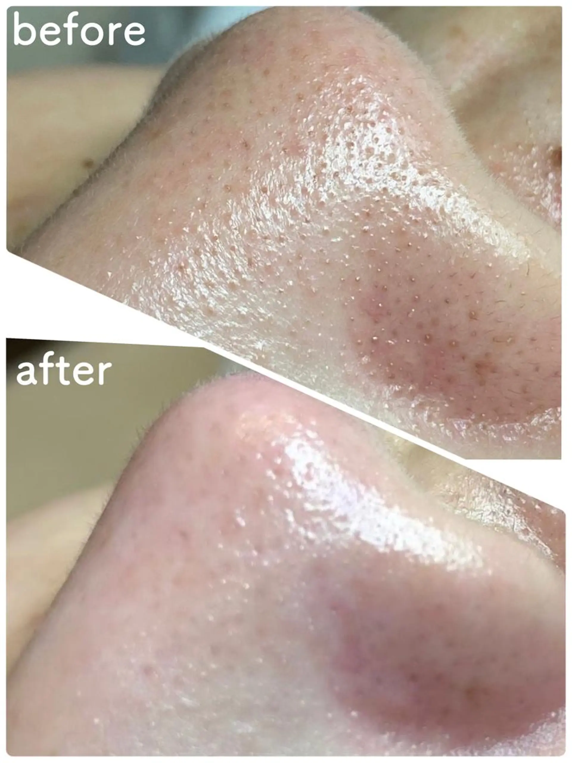 lumière d’espoirのエステ・リラクイメージ