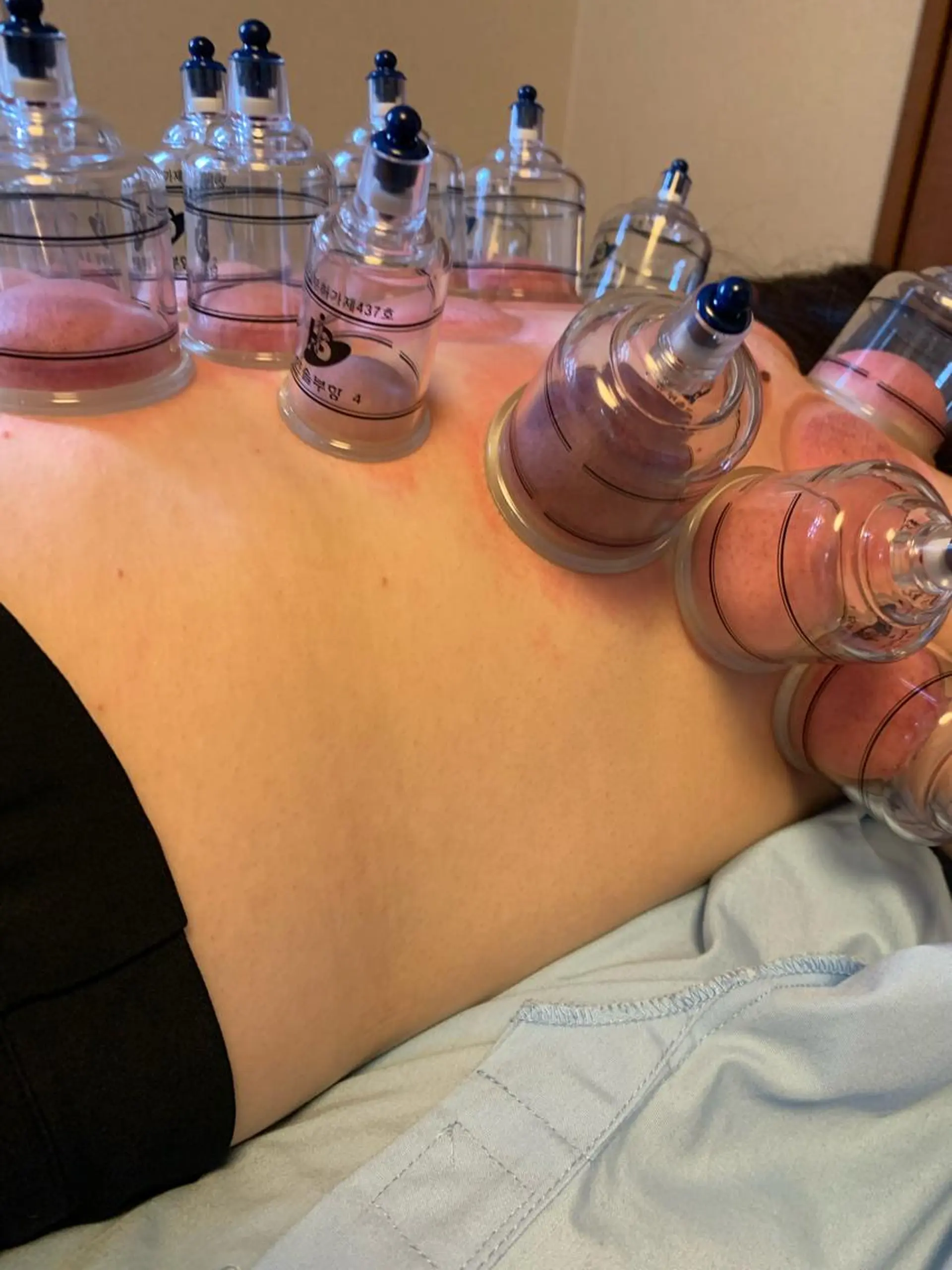 i鍼灸整体院所属・i鍼灸整体院 石井宏和のエステ・リラクイメージ