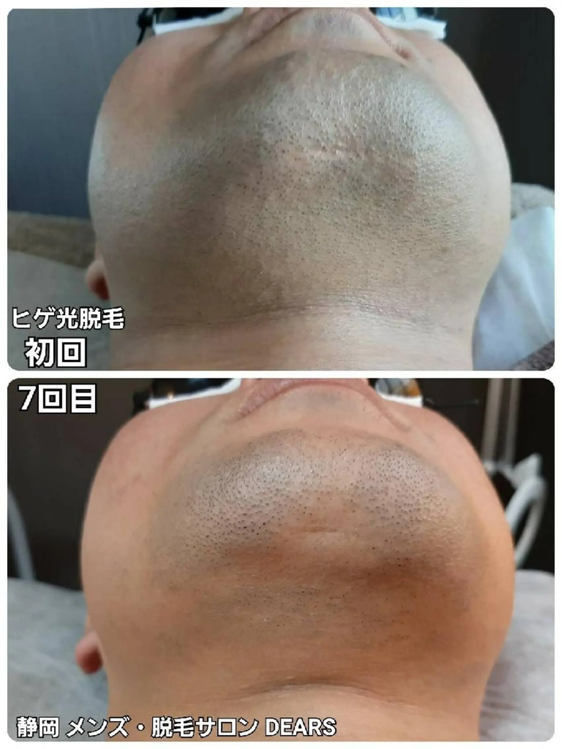 メンズ メンズ・脱毛サロン DEARS所属・山村幸久 メンズ脱毛 ディアーズのエステ・リラクイメージ